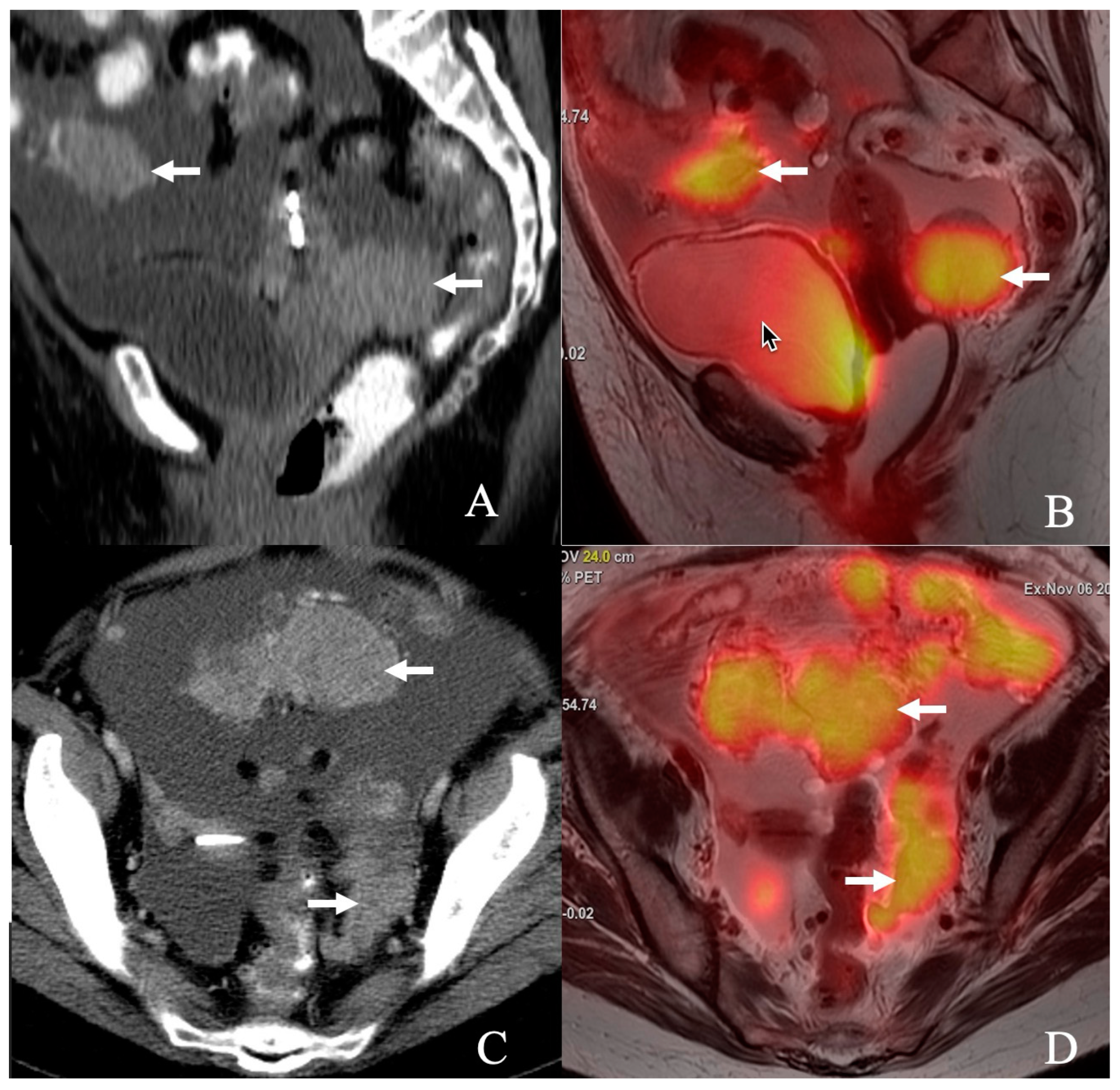 Cancers 17 02612 g001