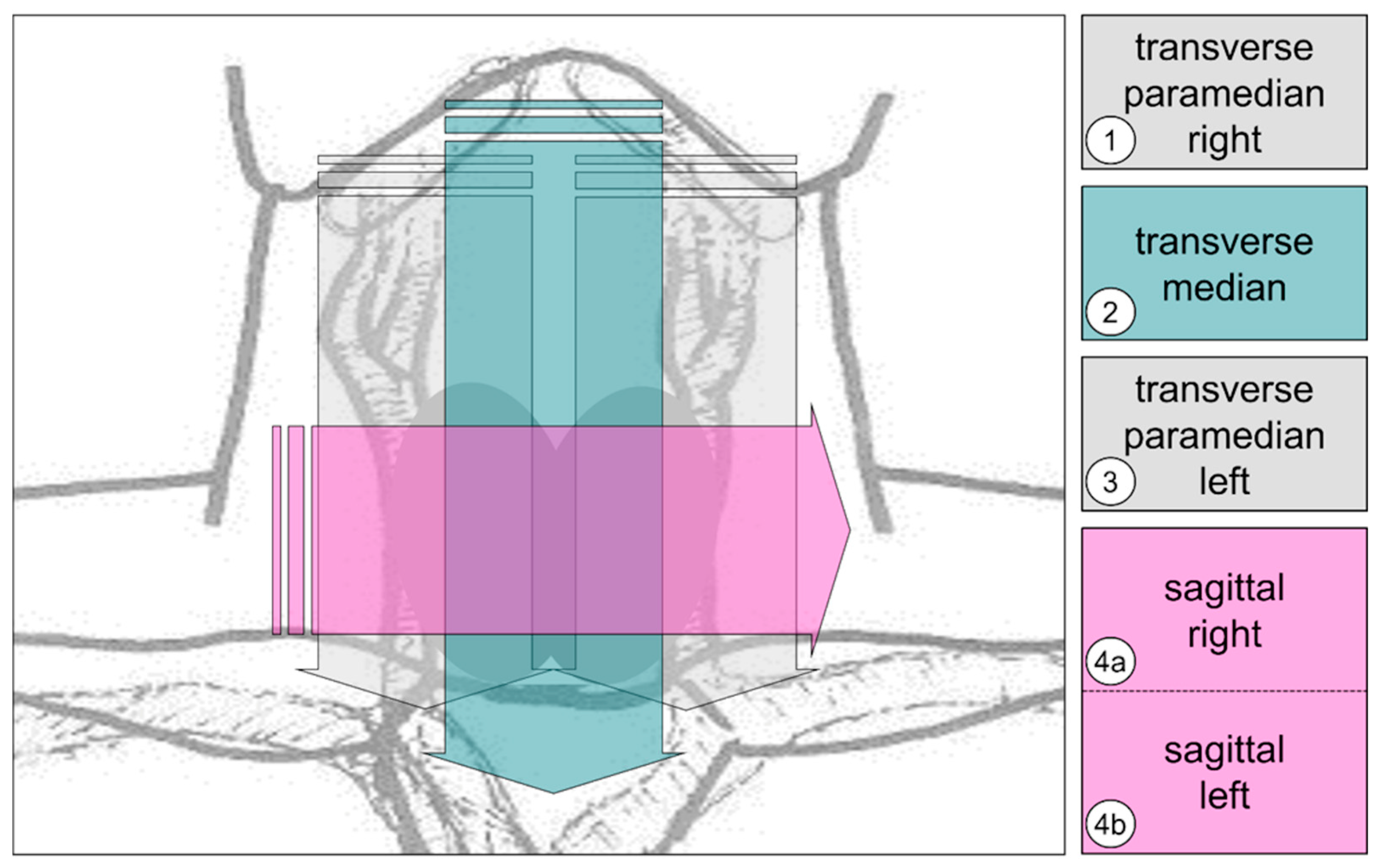 Cancers 17 02616 g002
