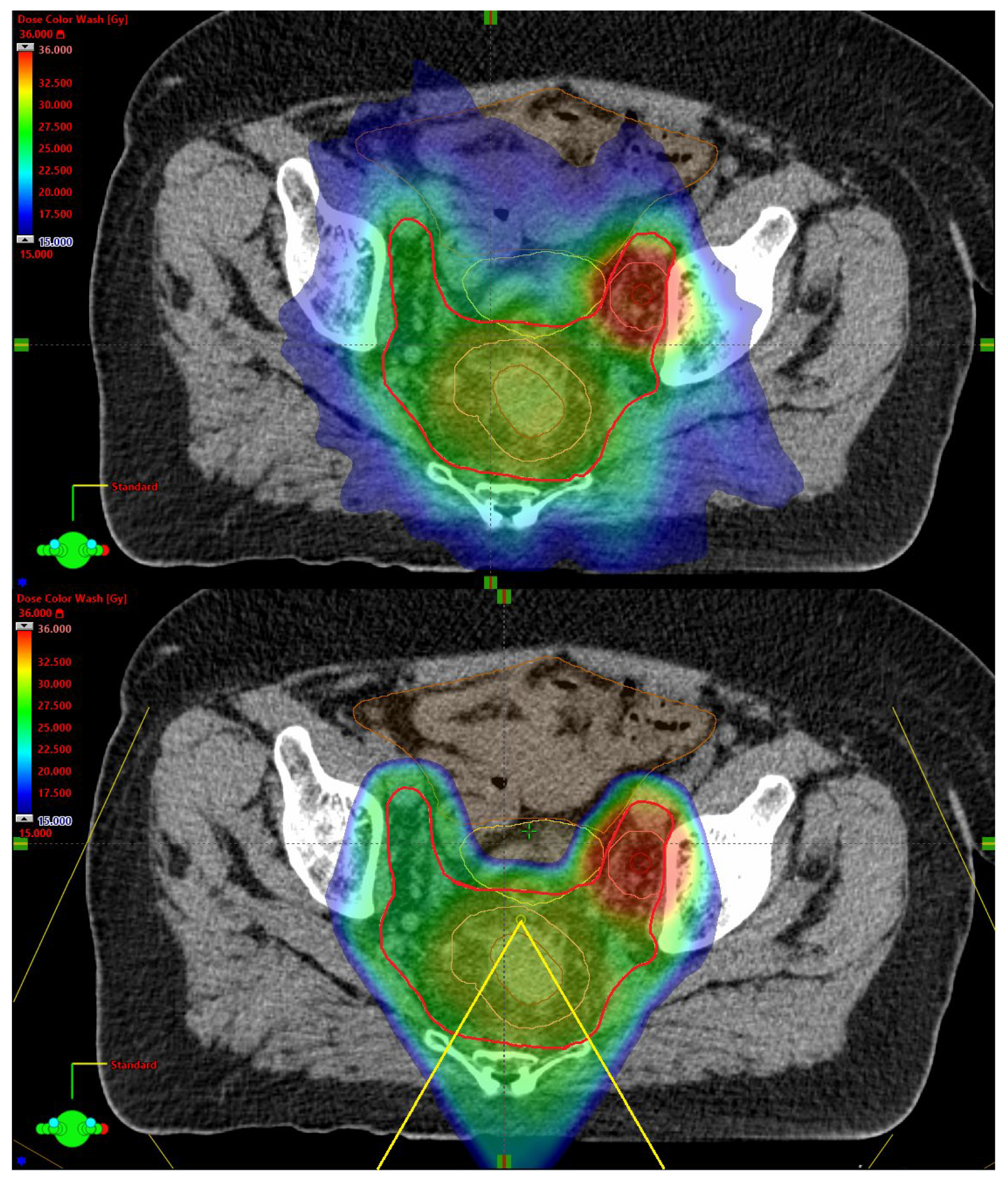 Cancers 17 02627 g001