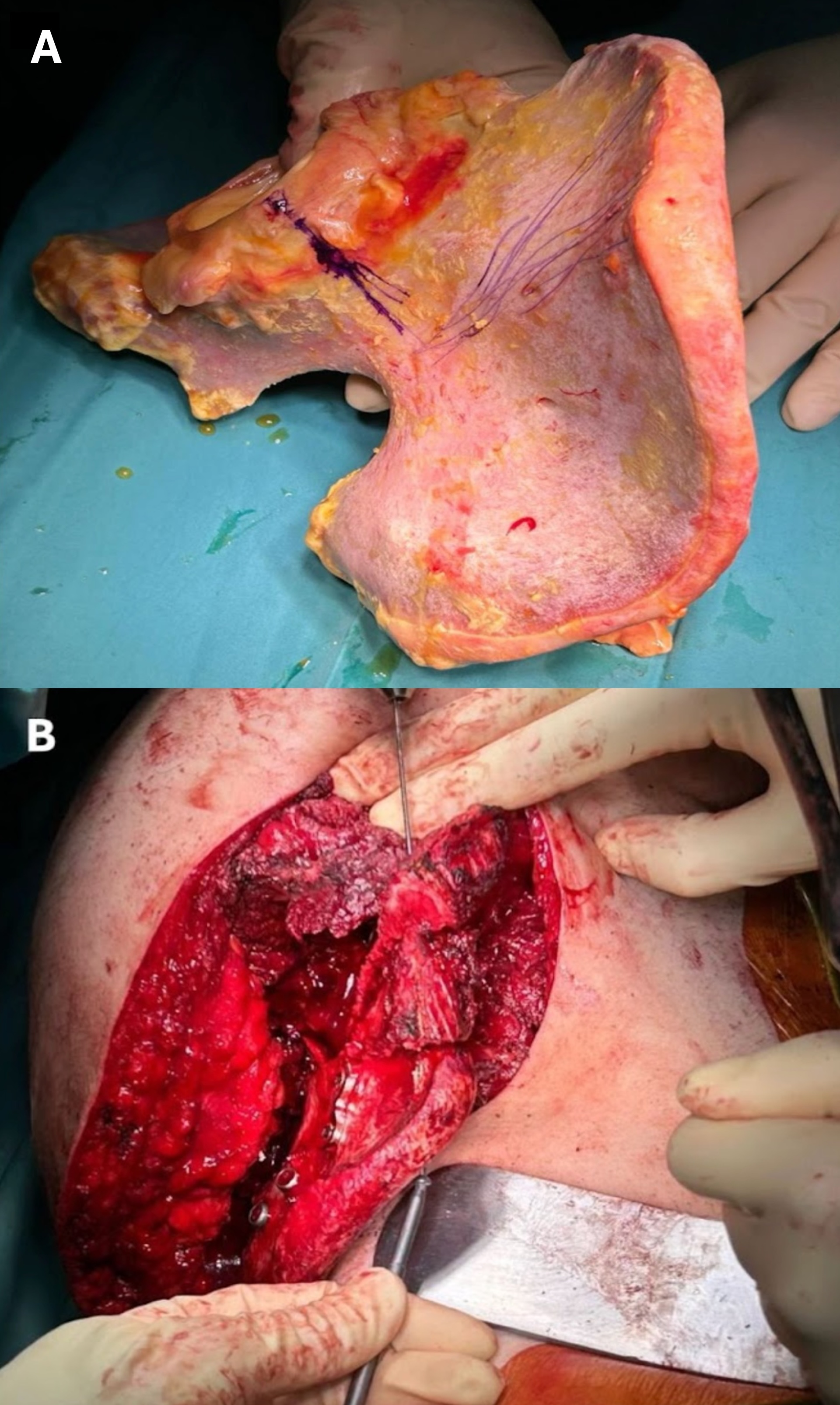 Cancers 17 02629 g001