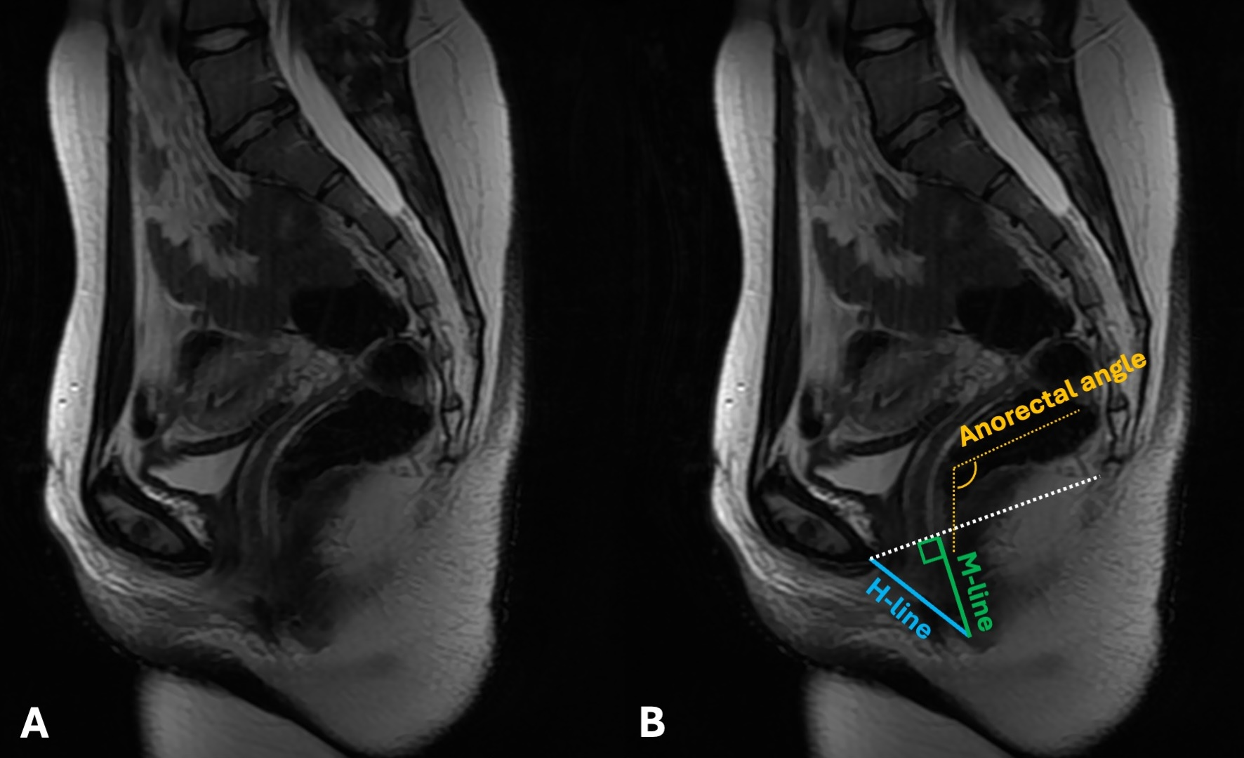 Cancers 17 02629 g003