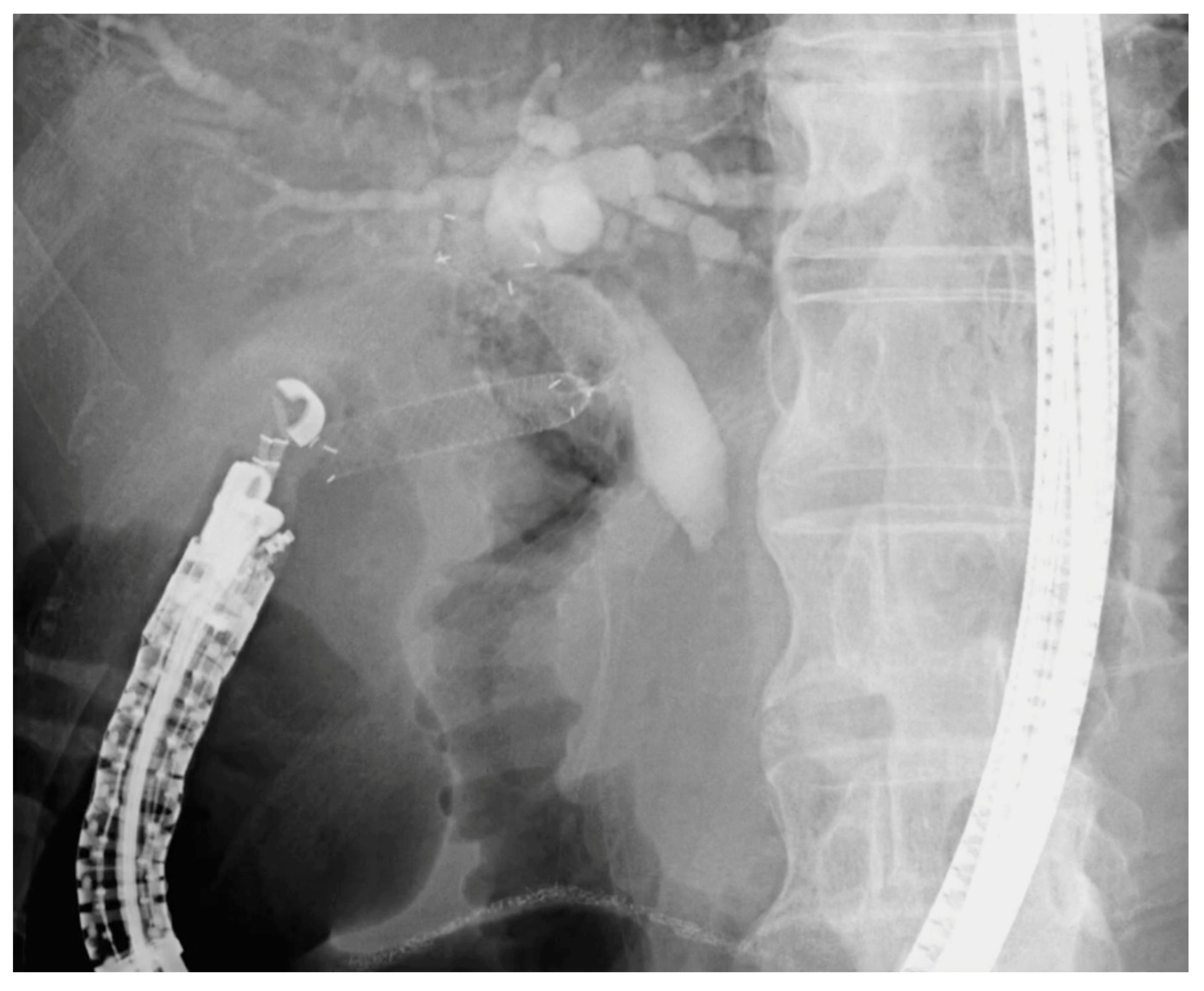 Cancers 17 02644 g002