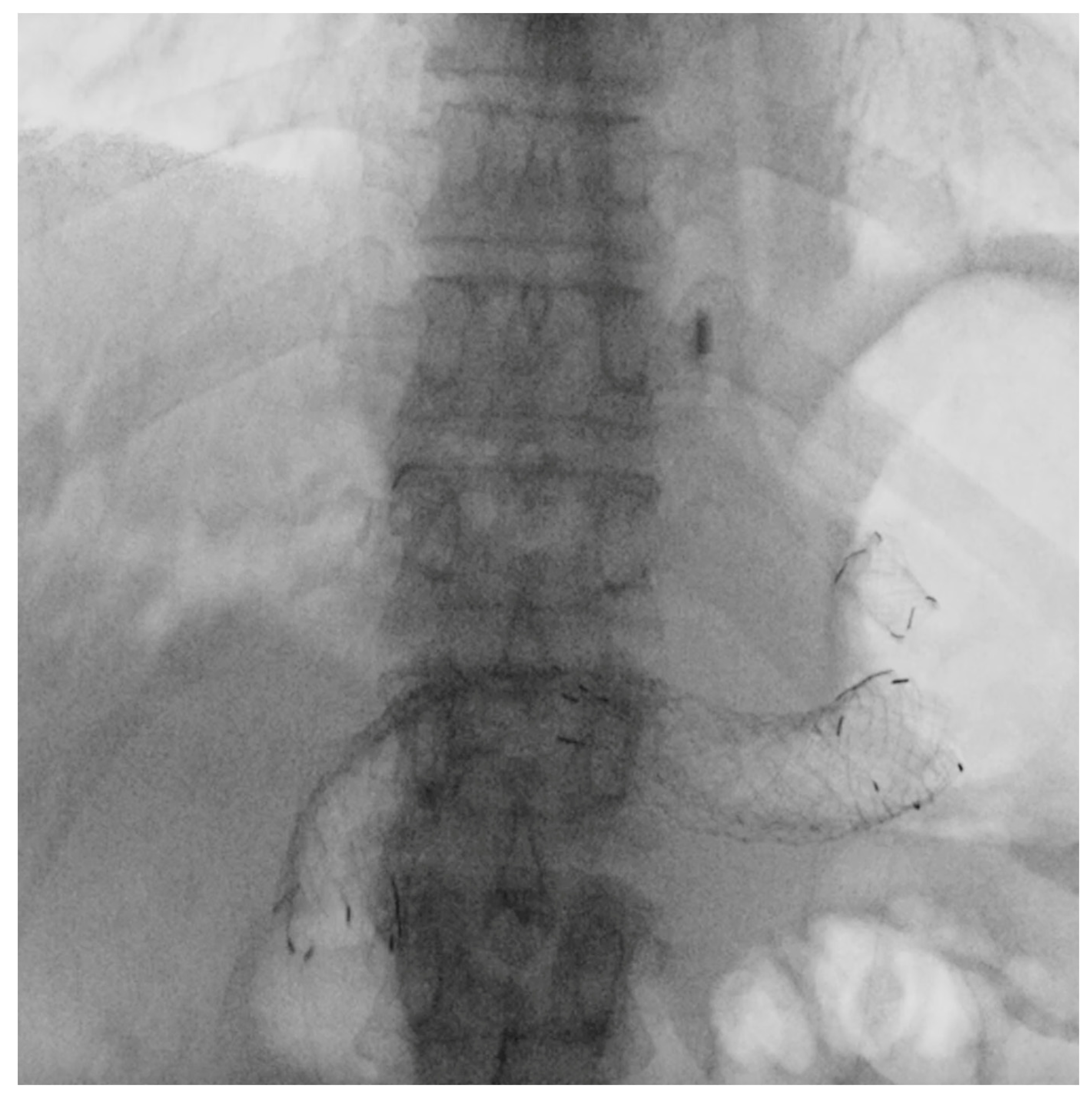 Cancers 17 02644 g005