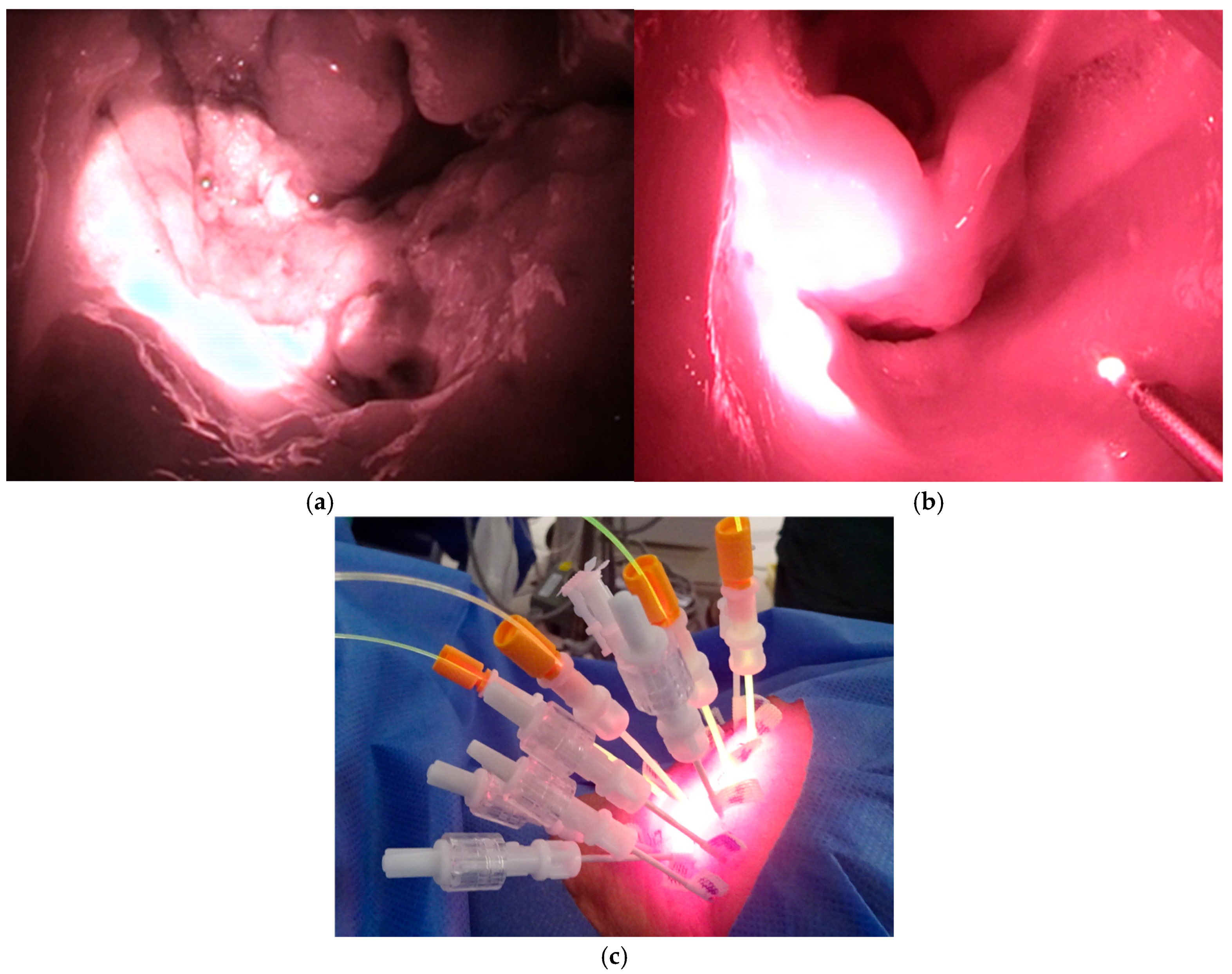 Cancers 17 02671 g001 Cancers 17 02671 g001