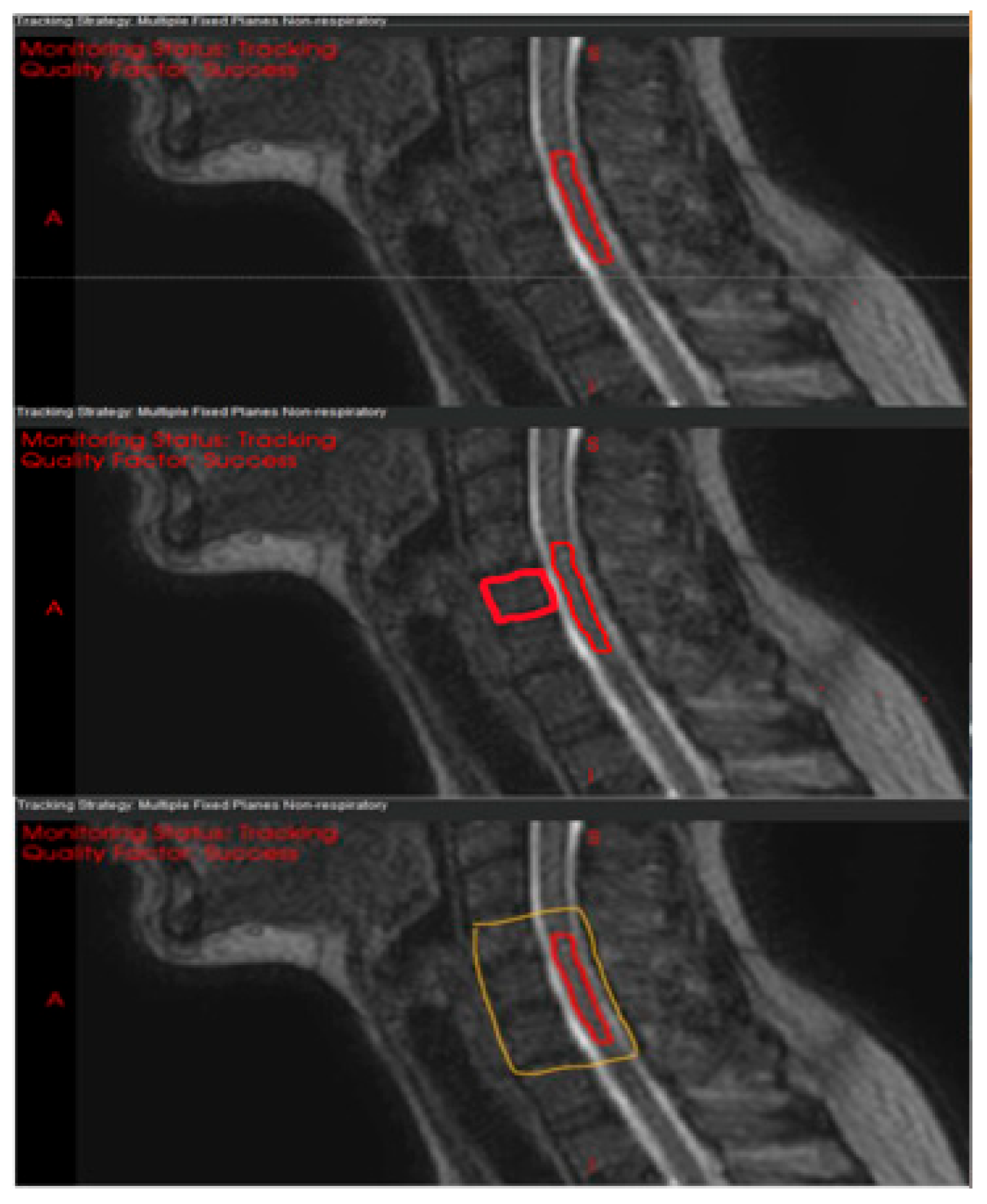 Cancers 17 02697 g001 Cancers 17 02697 g001