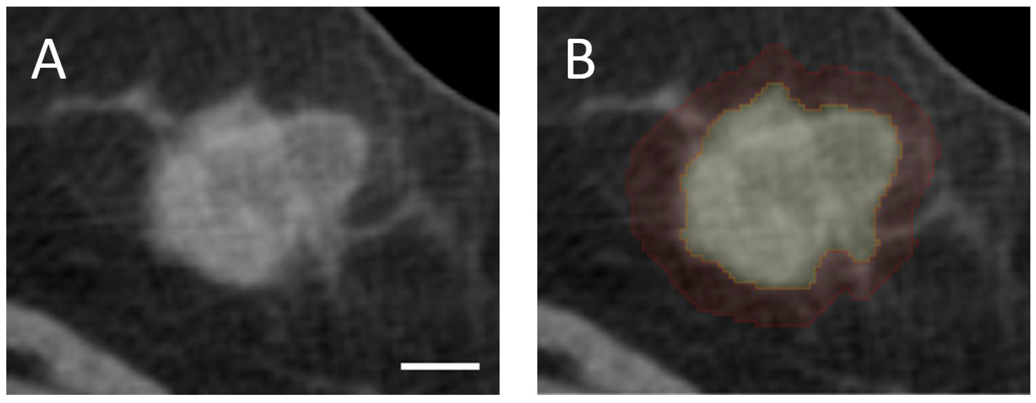 Cancers 17 02706 g001