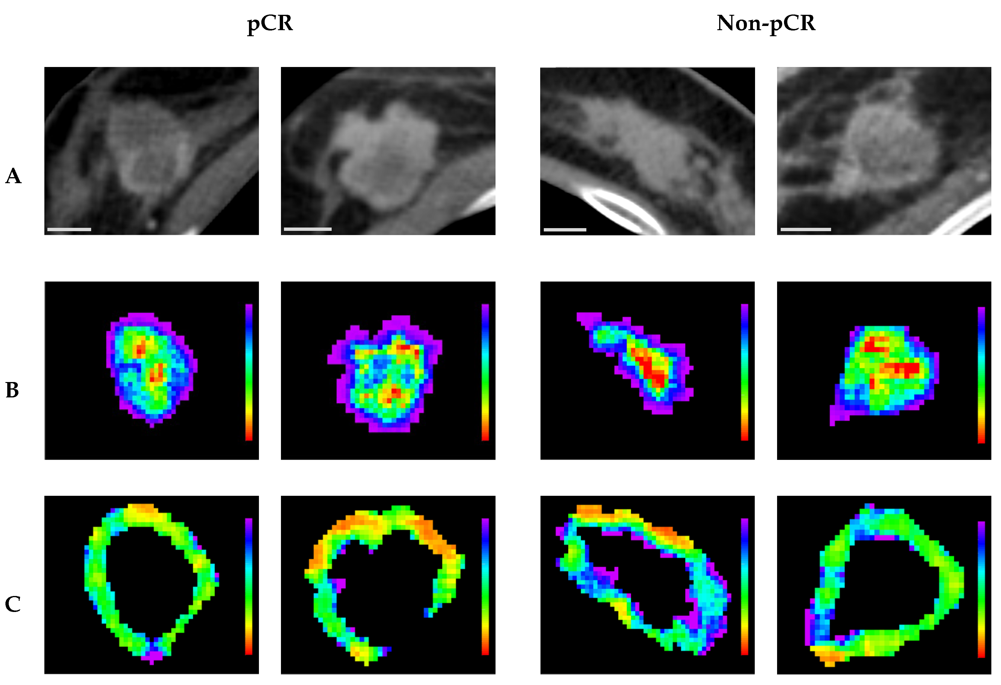 Cancers 17 02706 g006