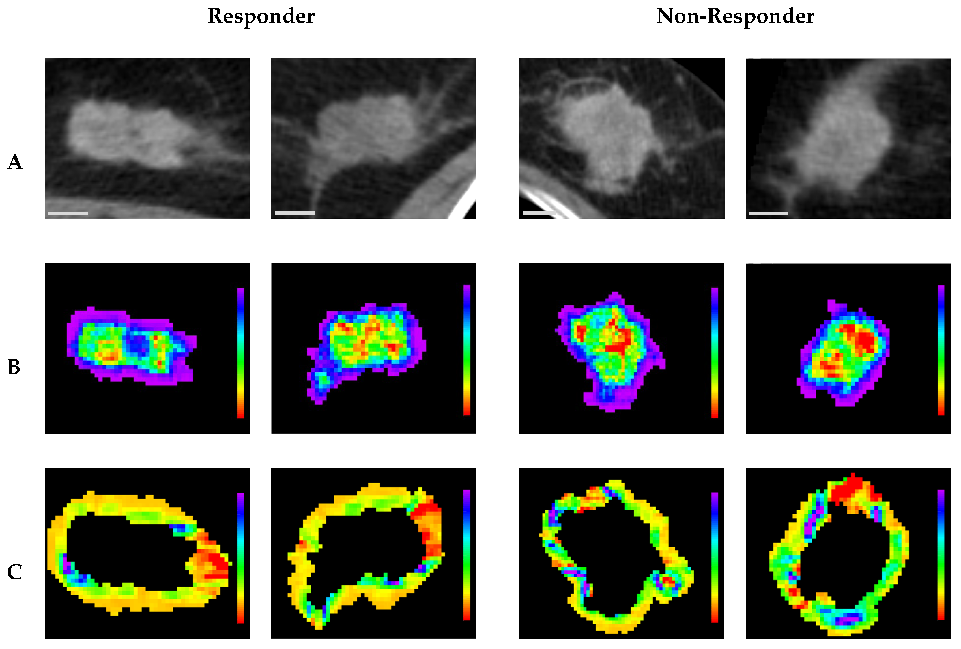 Cancers 17 02706 g007