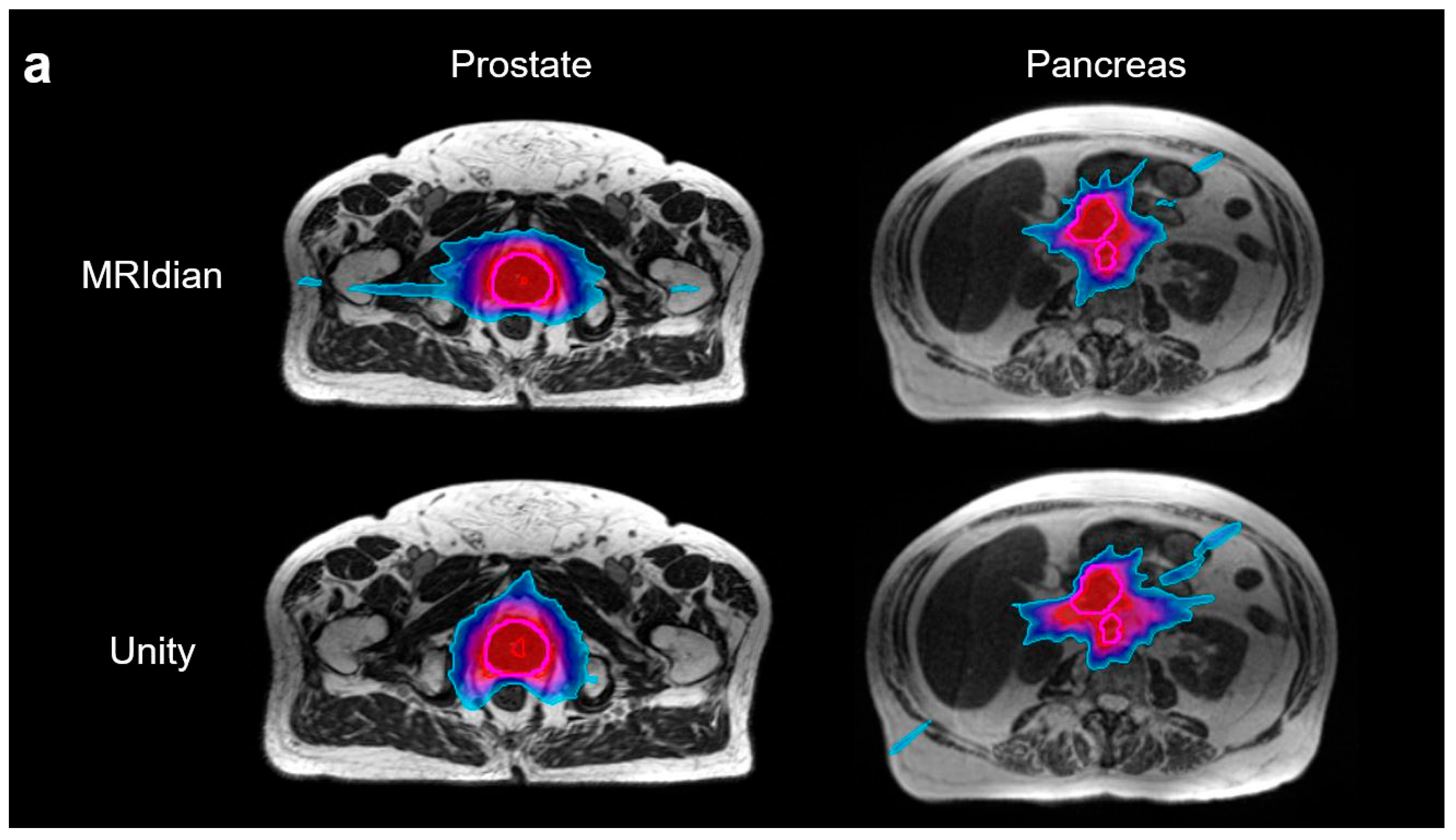 Cancers 17 02708 g003a Cancers 17 02708 g003a