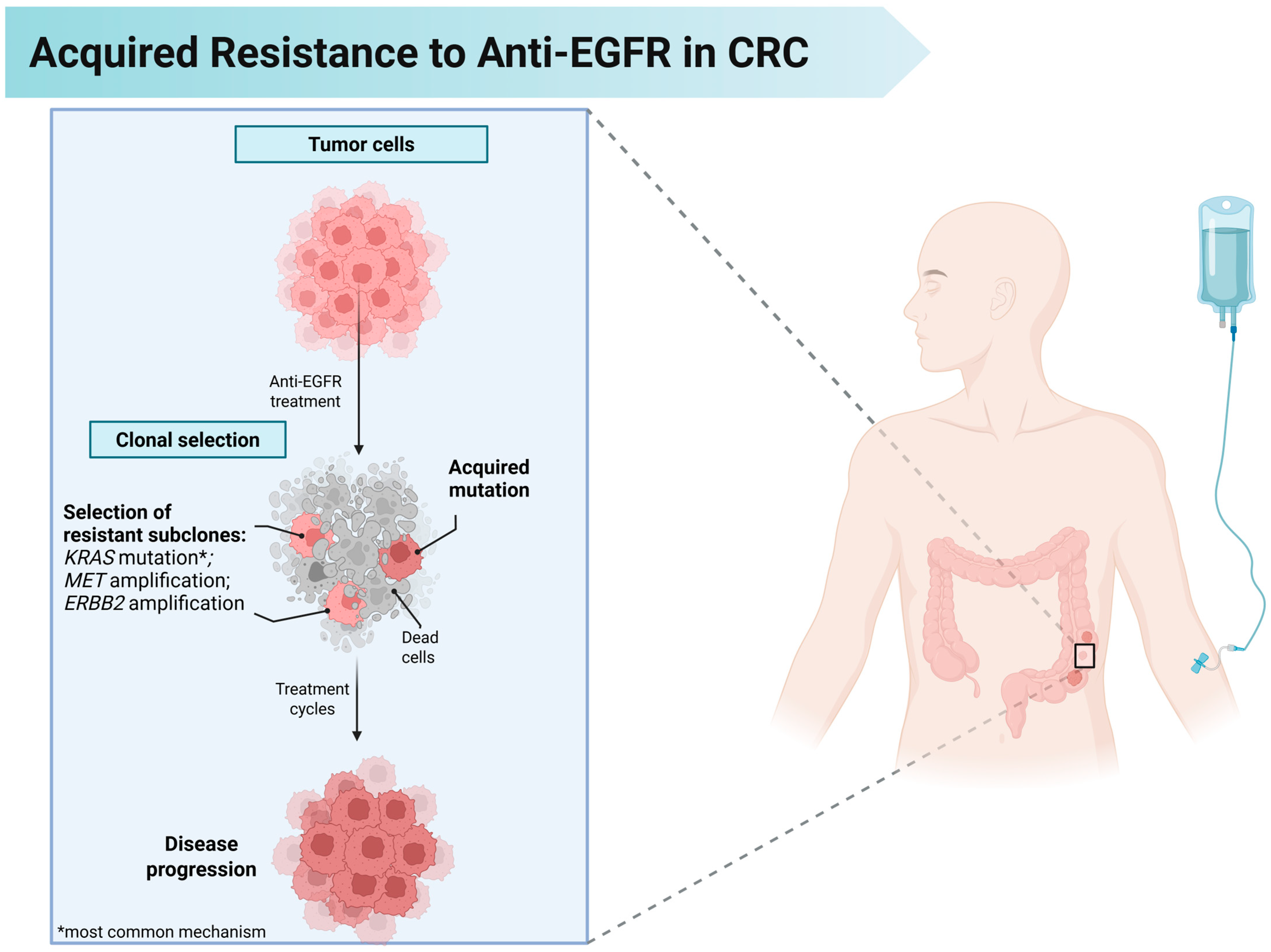 Cancers 17 02804 g002