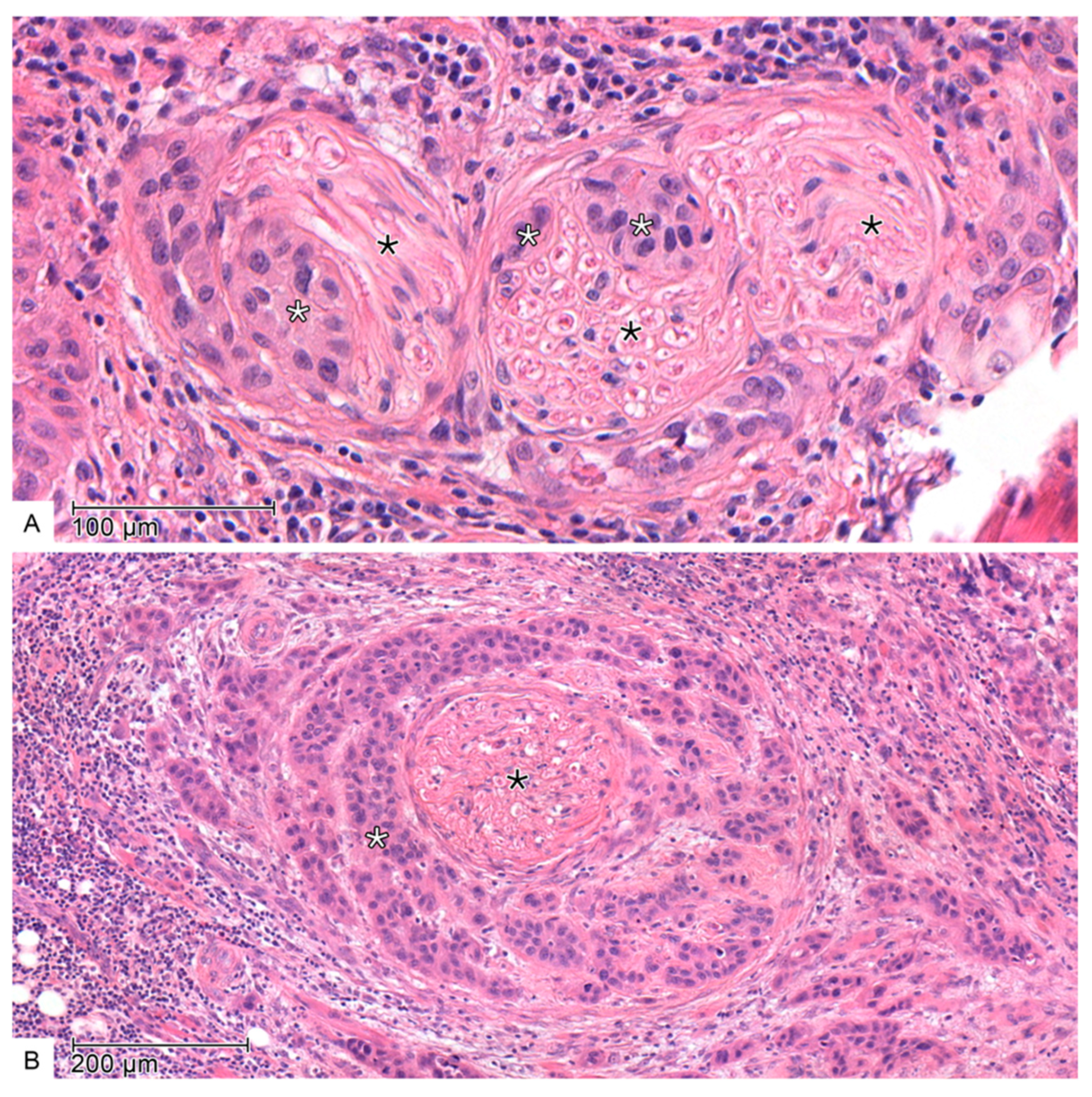 Cancers 17 02812 g002 Cancers 17 02812 g002