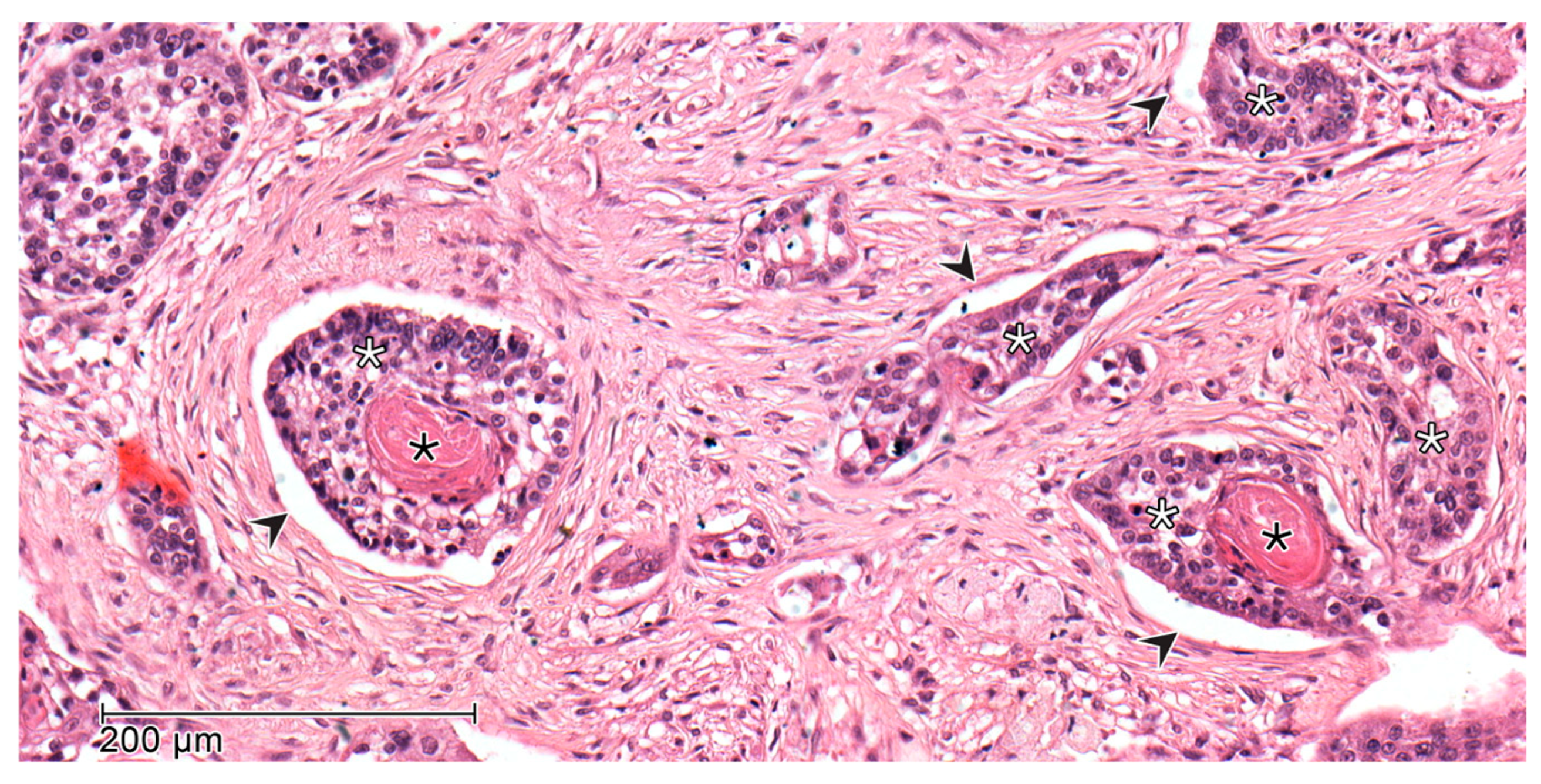 Cancers 17 02812 g003 Cancers 17 02812 g003