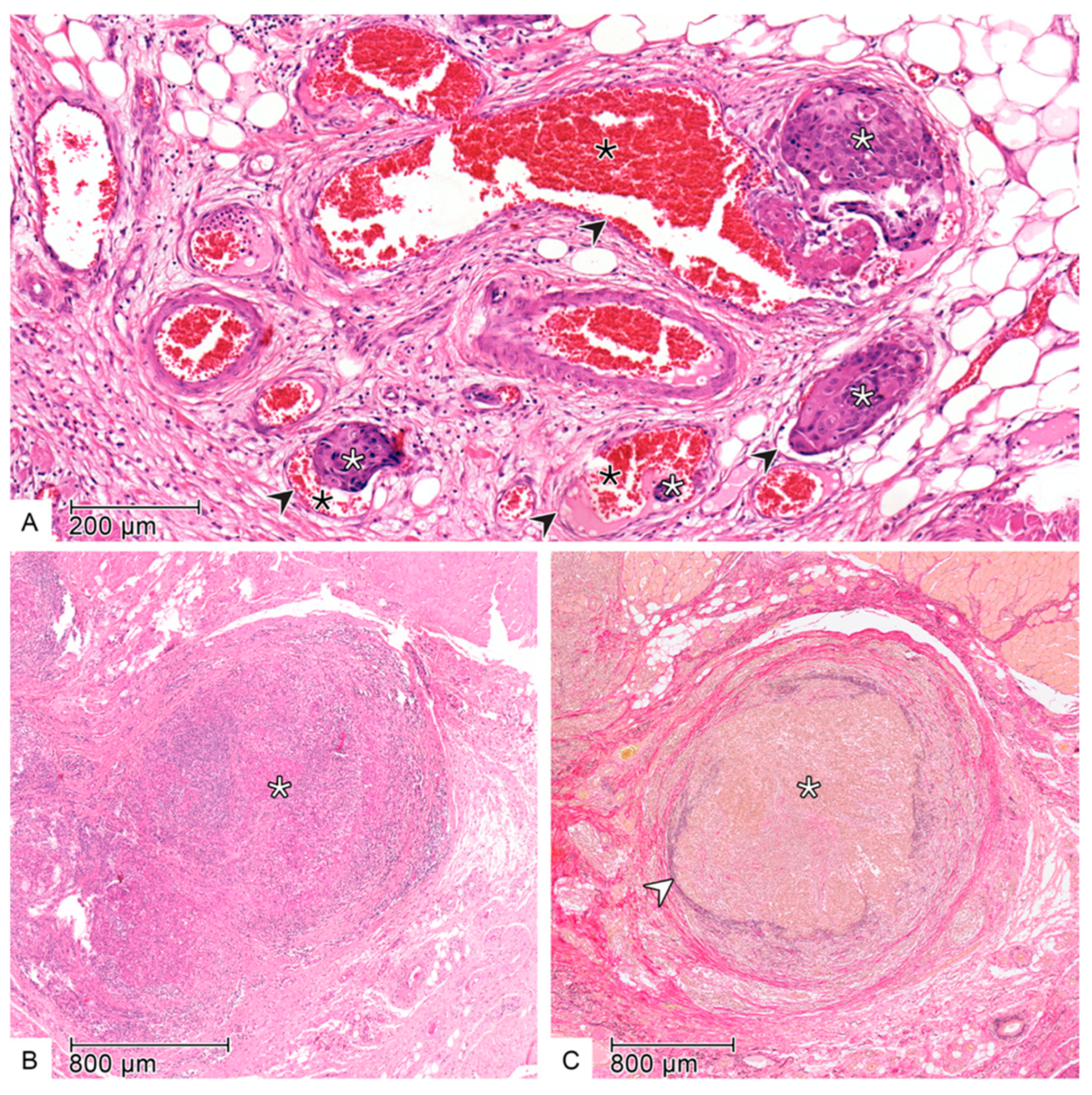 Cancers 17 02812 g004 Cancers 17 02812 g004