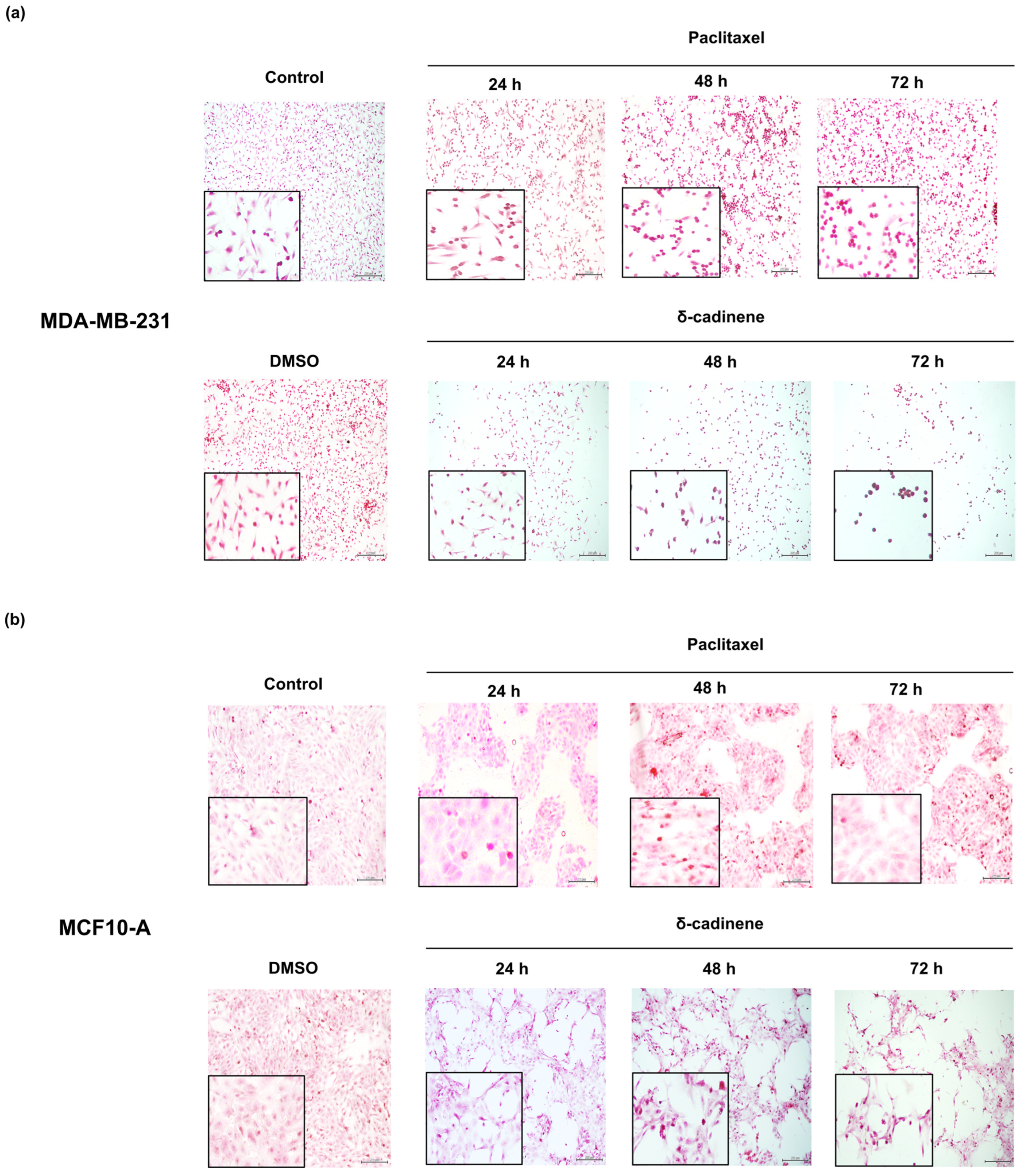 Cancers 17 02839 g011