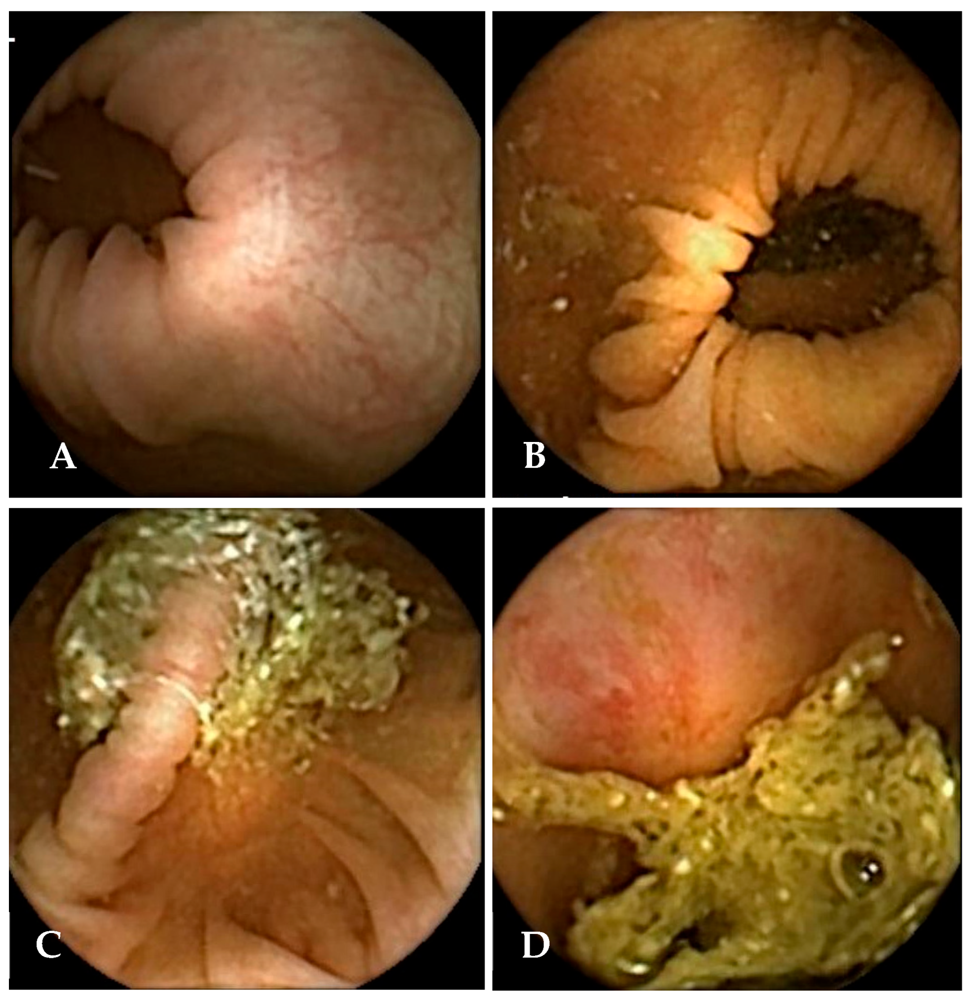 Cancers 17 02840 g003