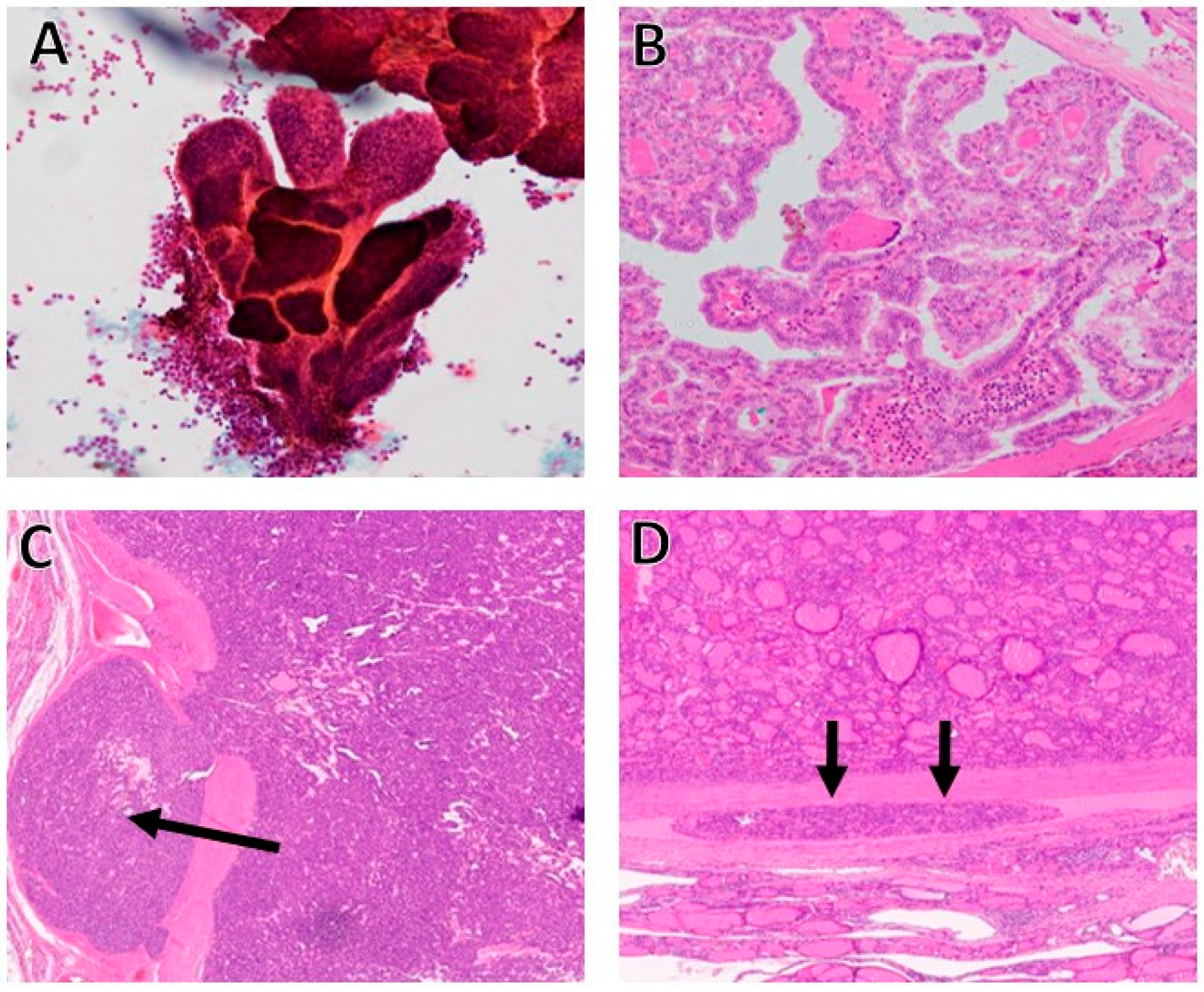 Cancers 17 02869 g001