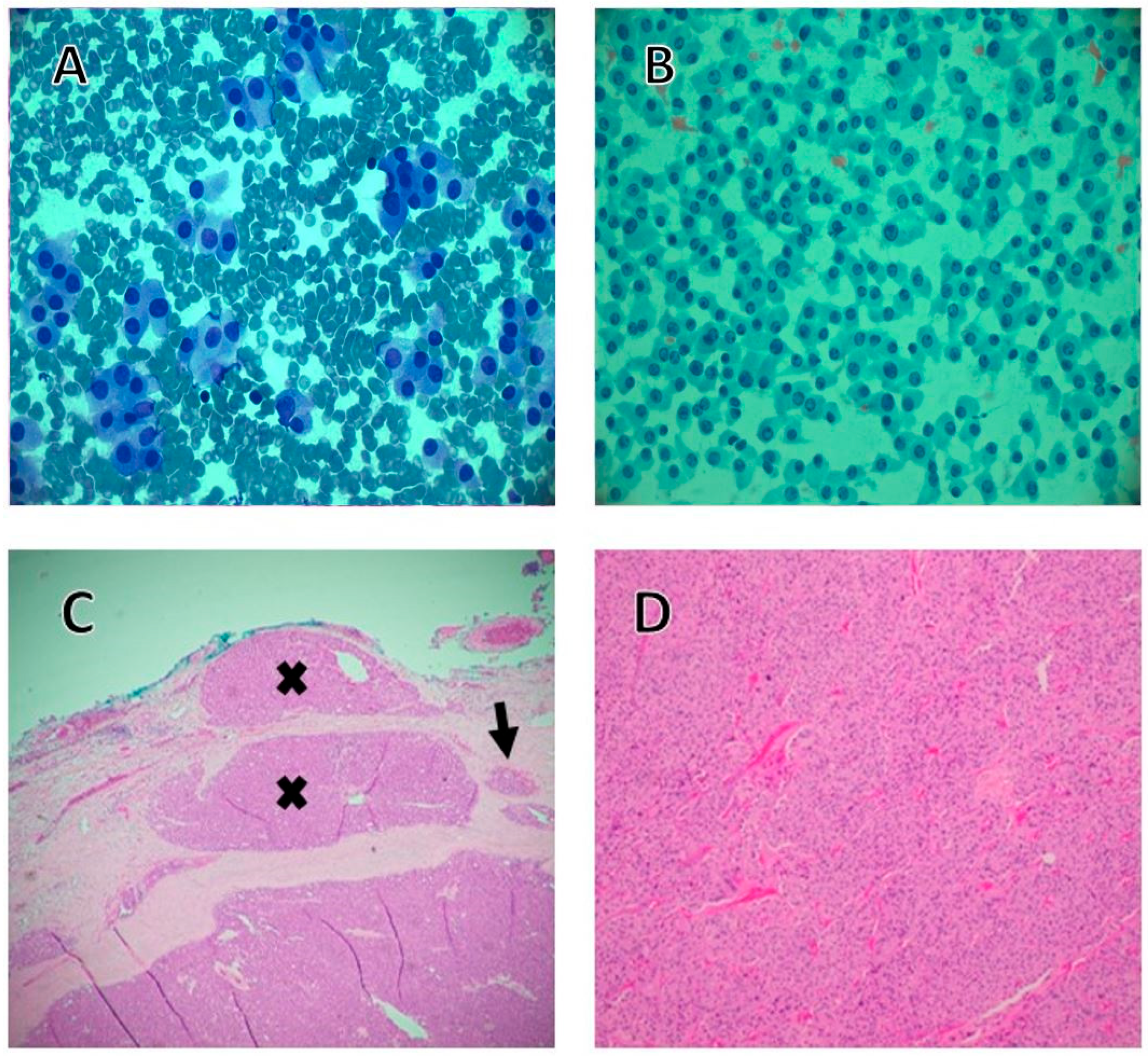 Cancers 17 02869 g002