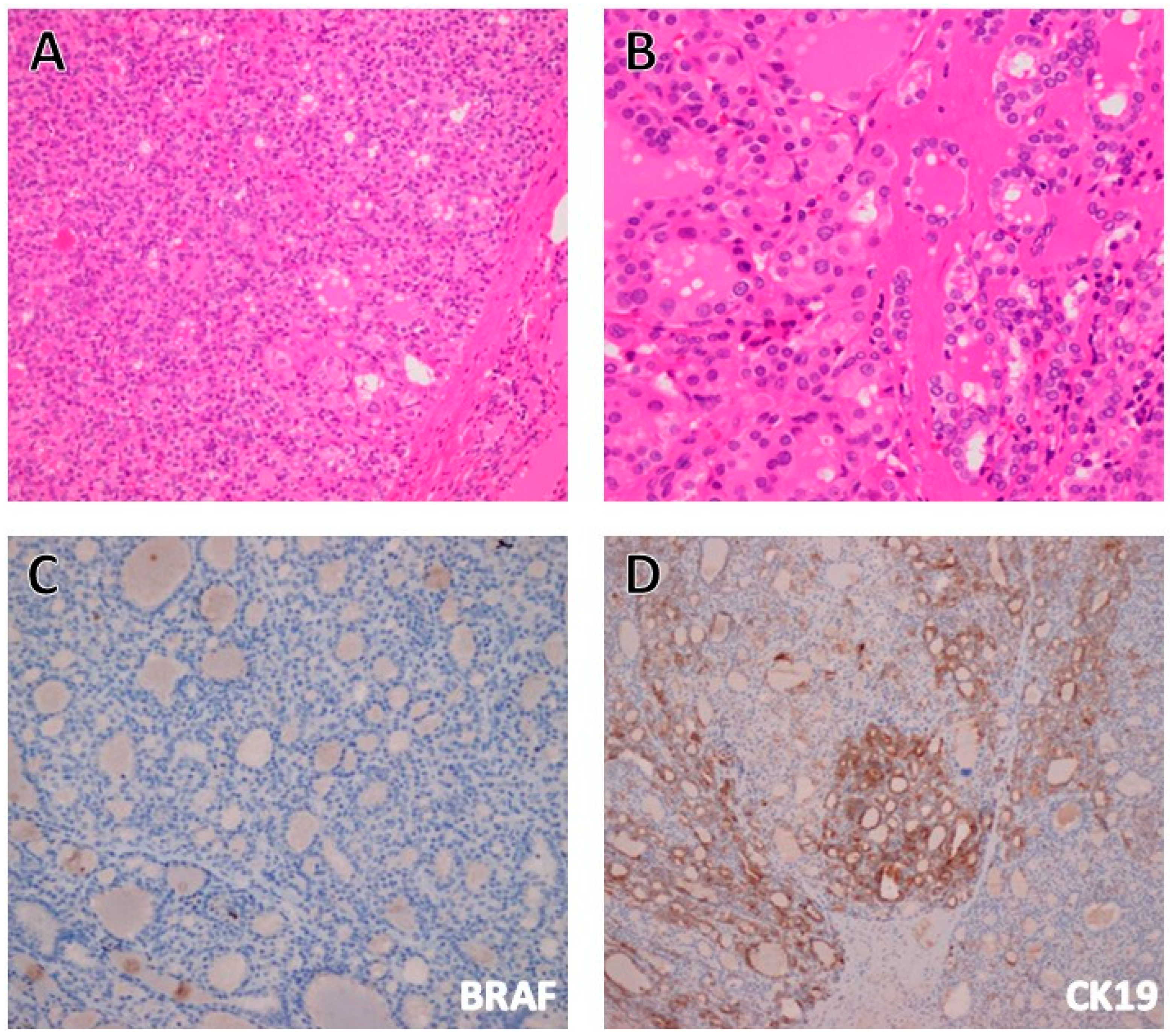 Cancers 17 02869 g003