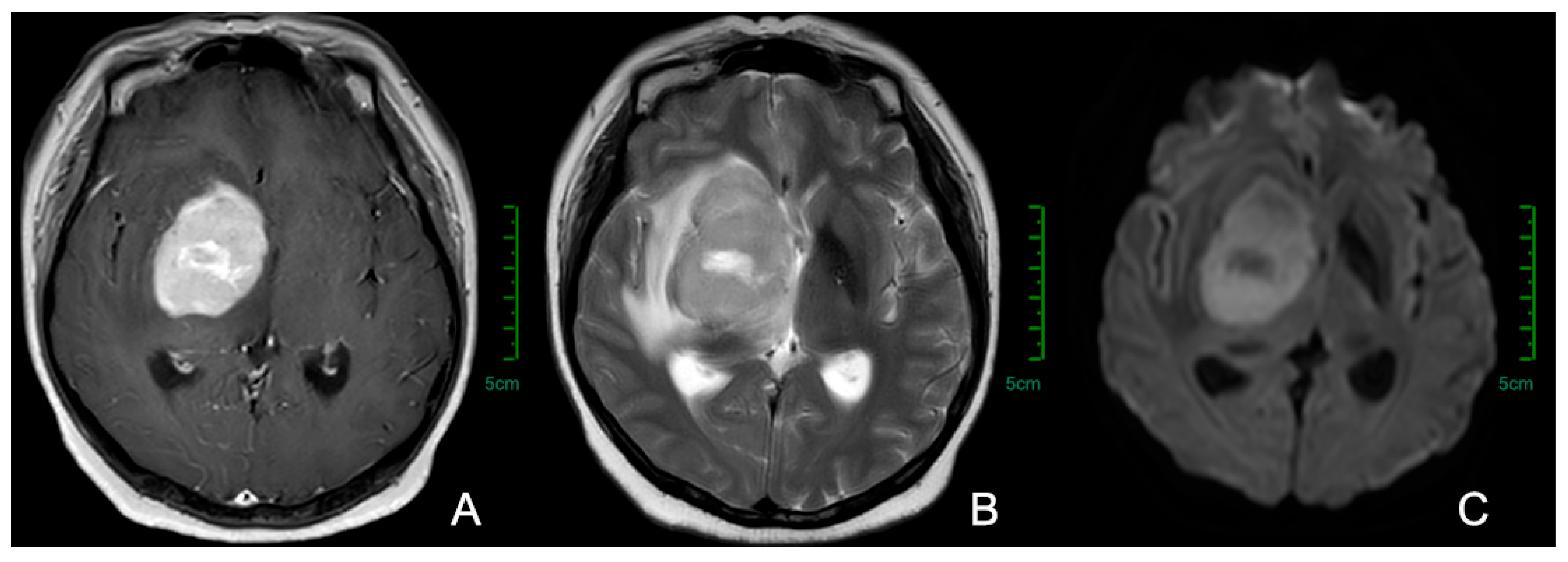 Cancers 17 02909 g001