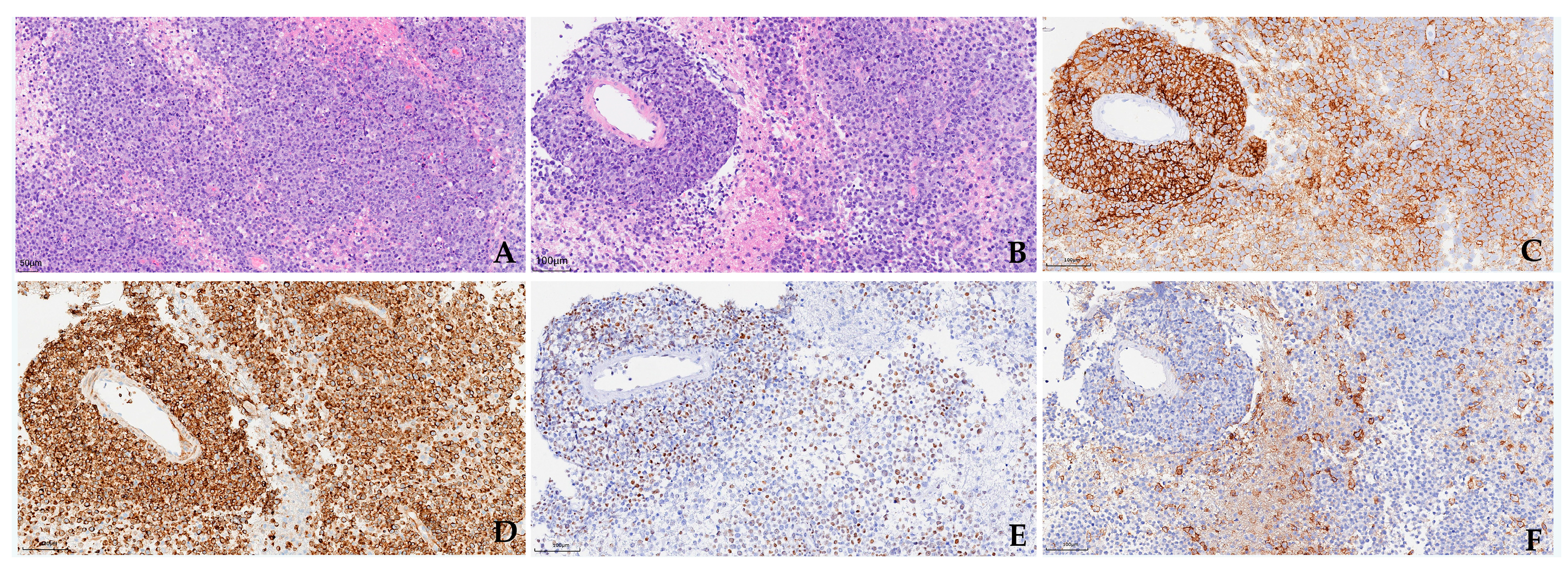 Cancers 17 02909 g002