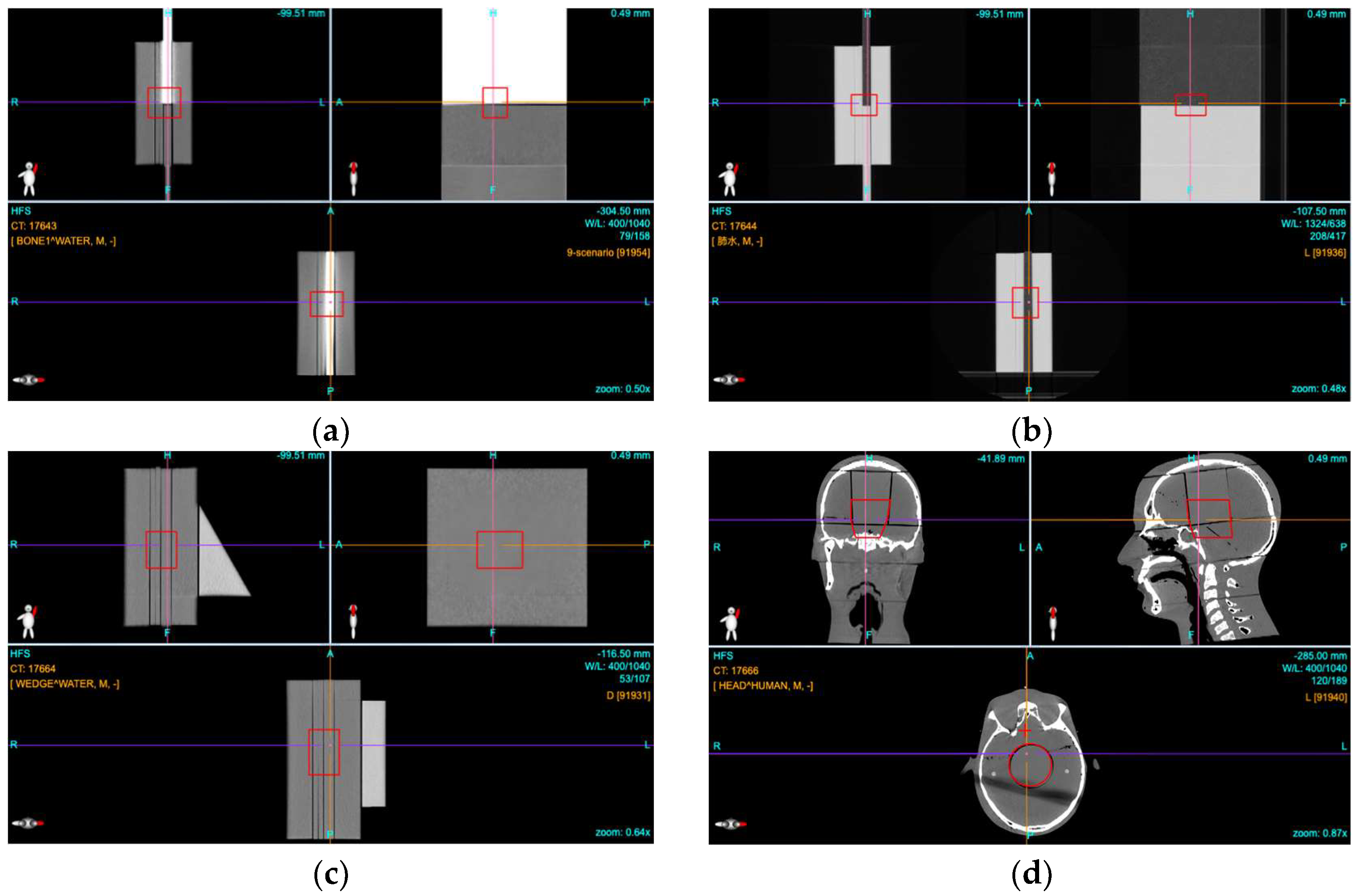 Cancers 17 02927 g002