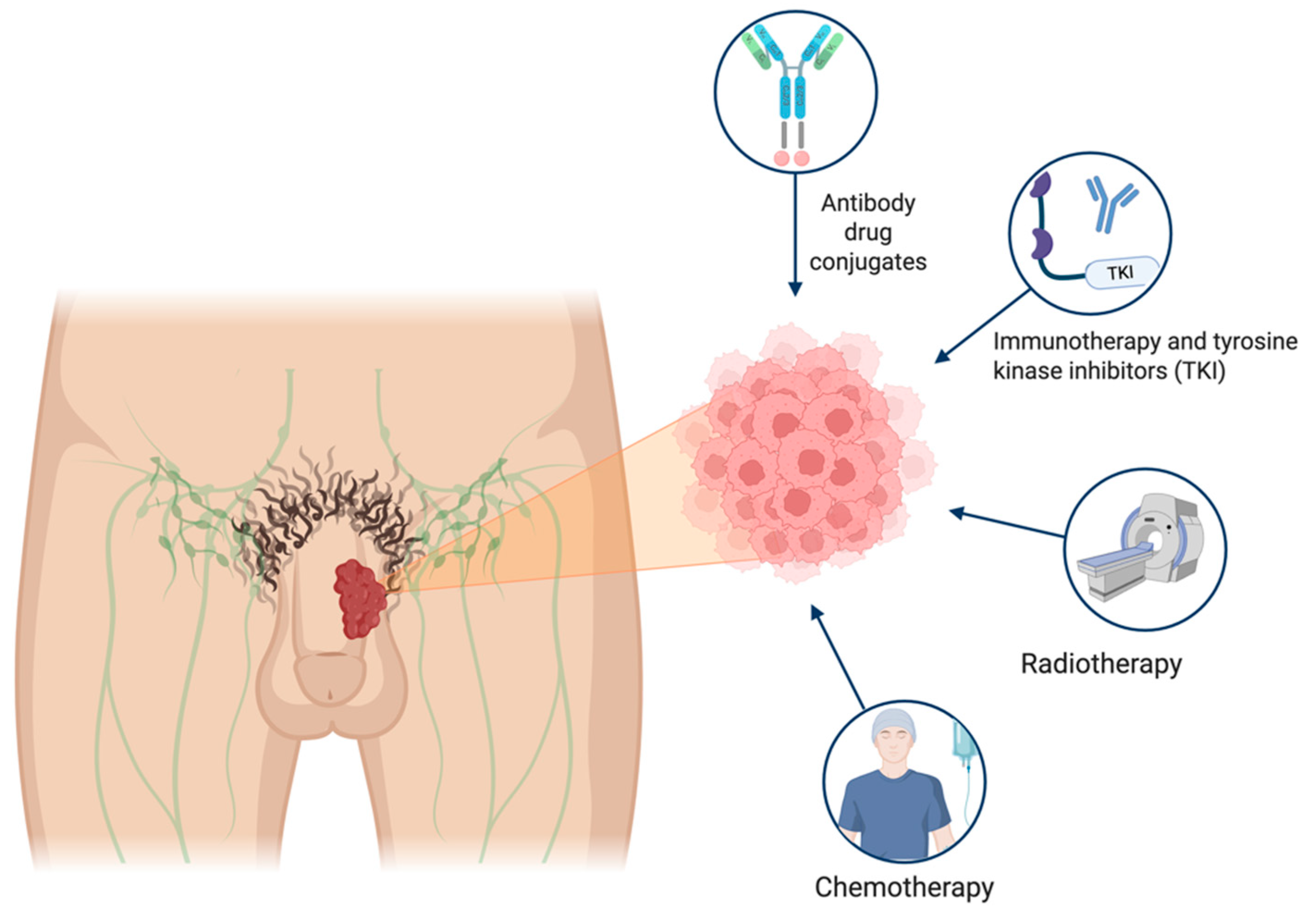 Cancers 17 02956 g001