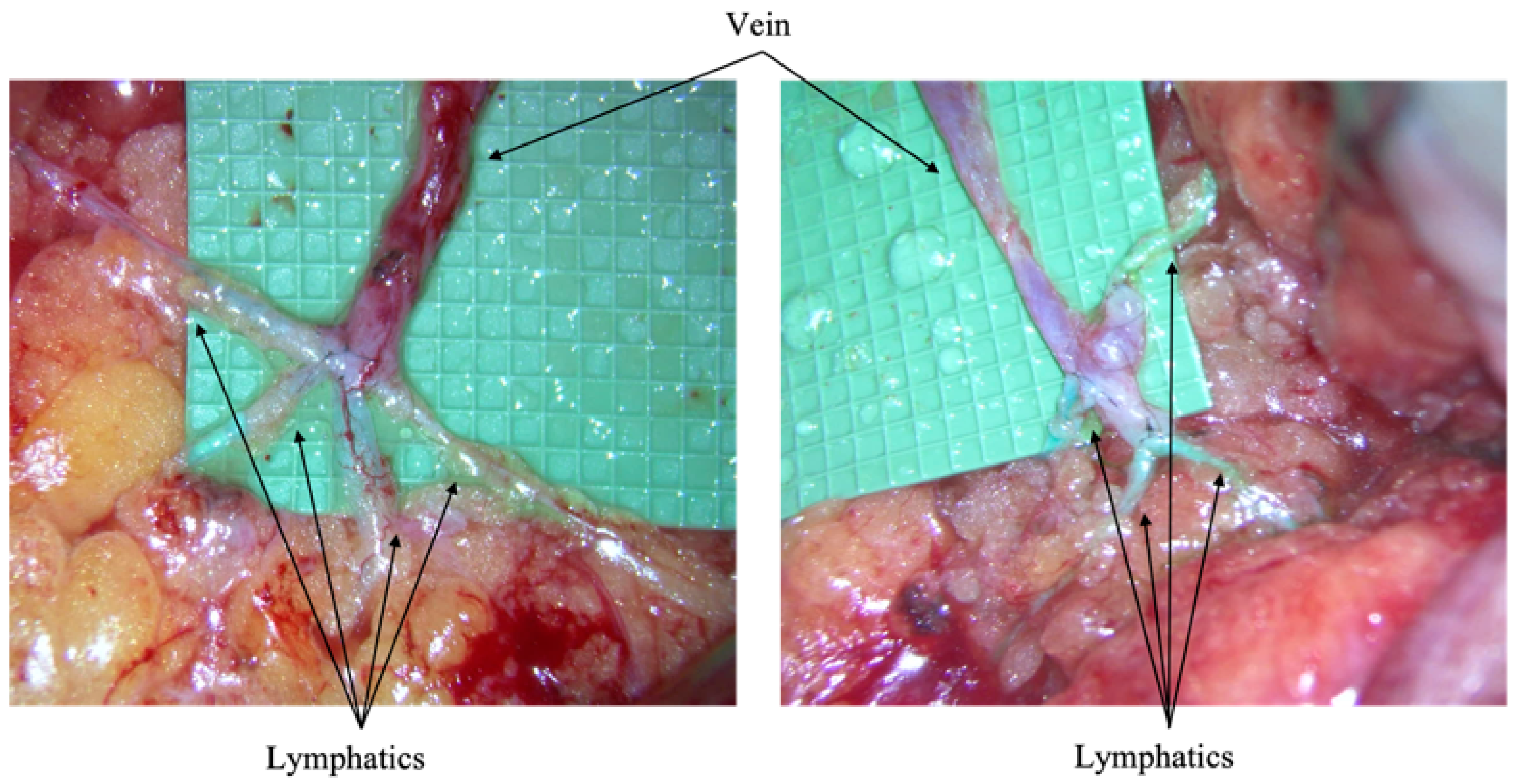 Cancers 17 02964 g001 Cancers 17 02964 g001