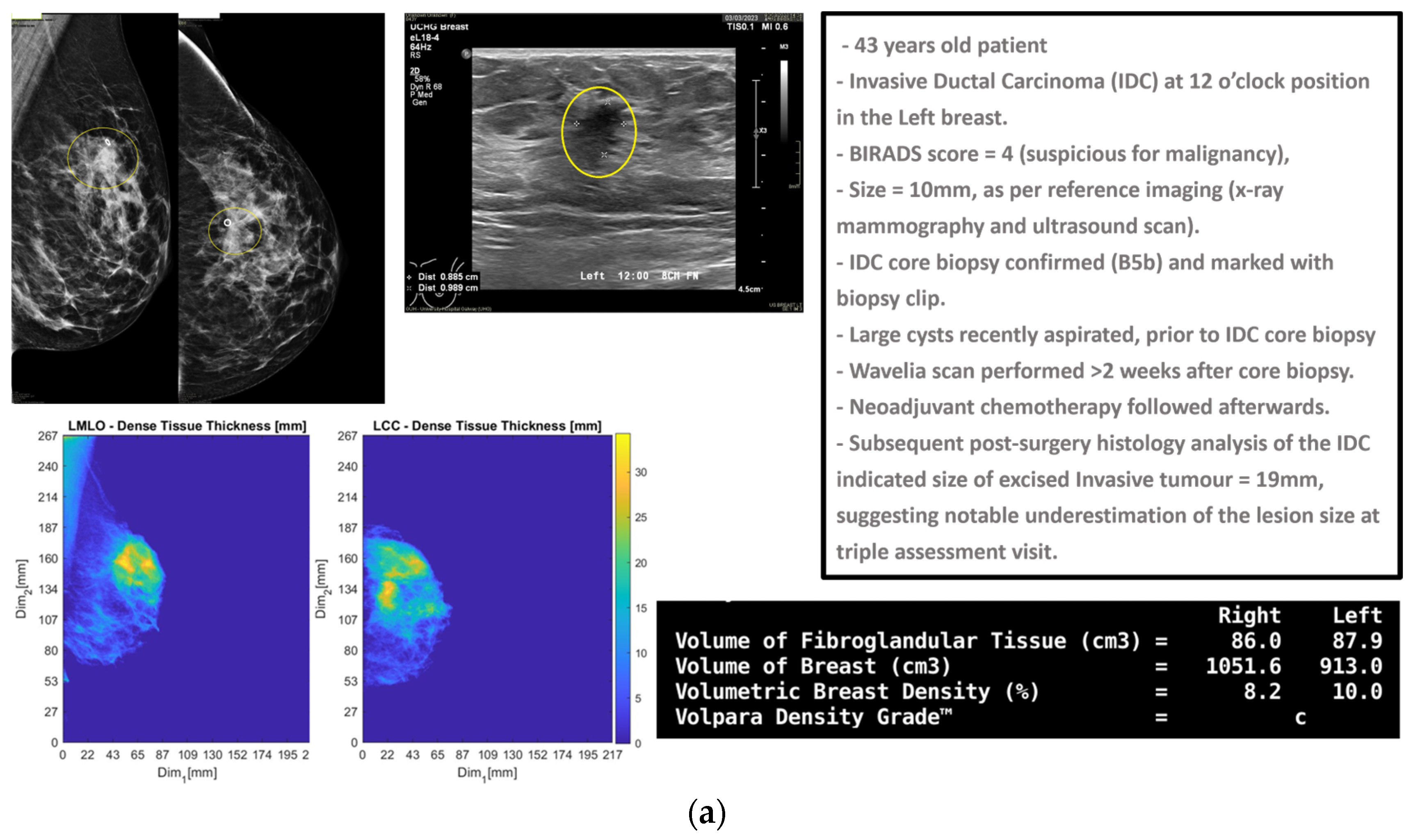 Cancers 17 02973 g001a