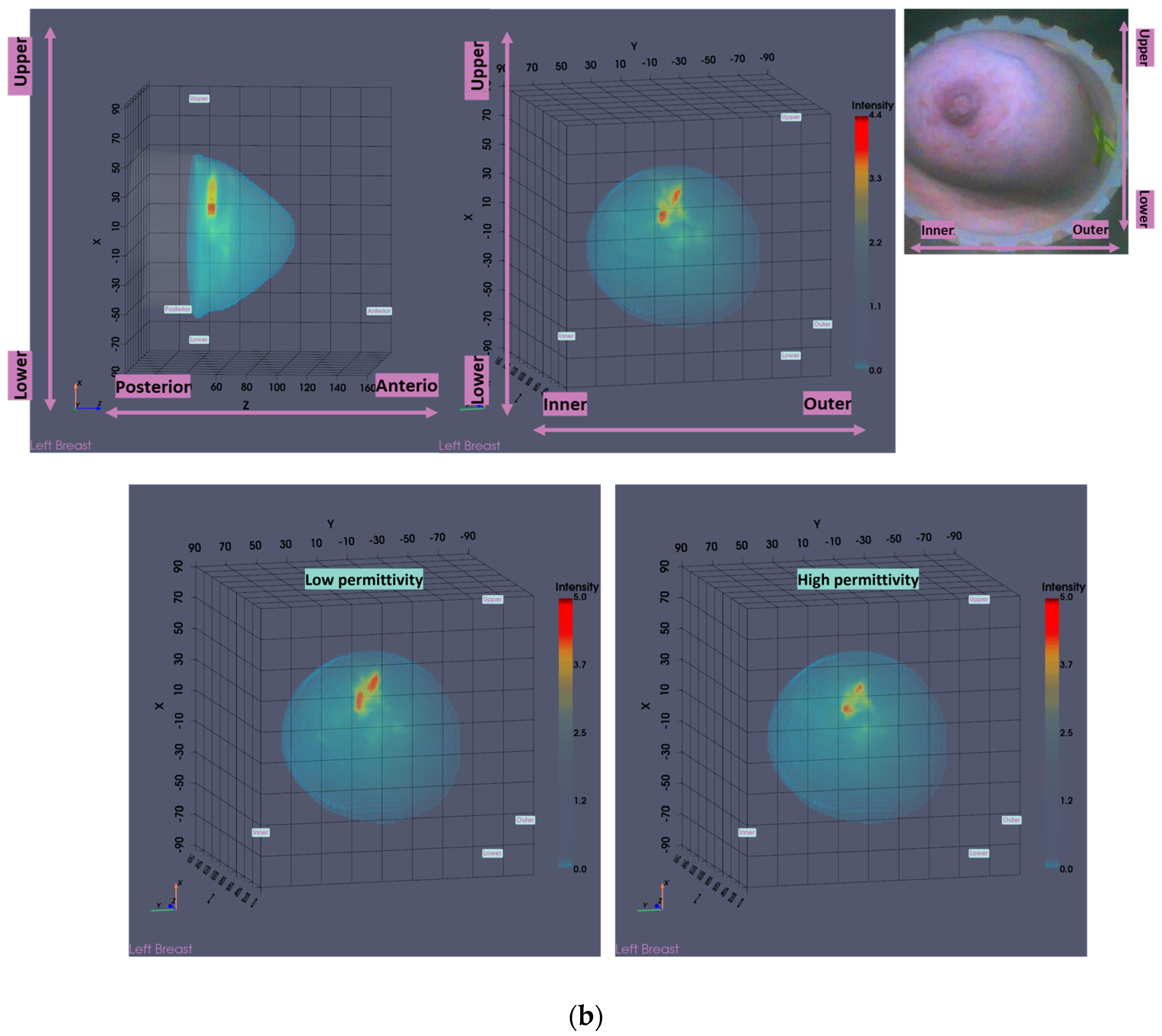 Cancers 17 02973 g001b