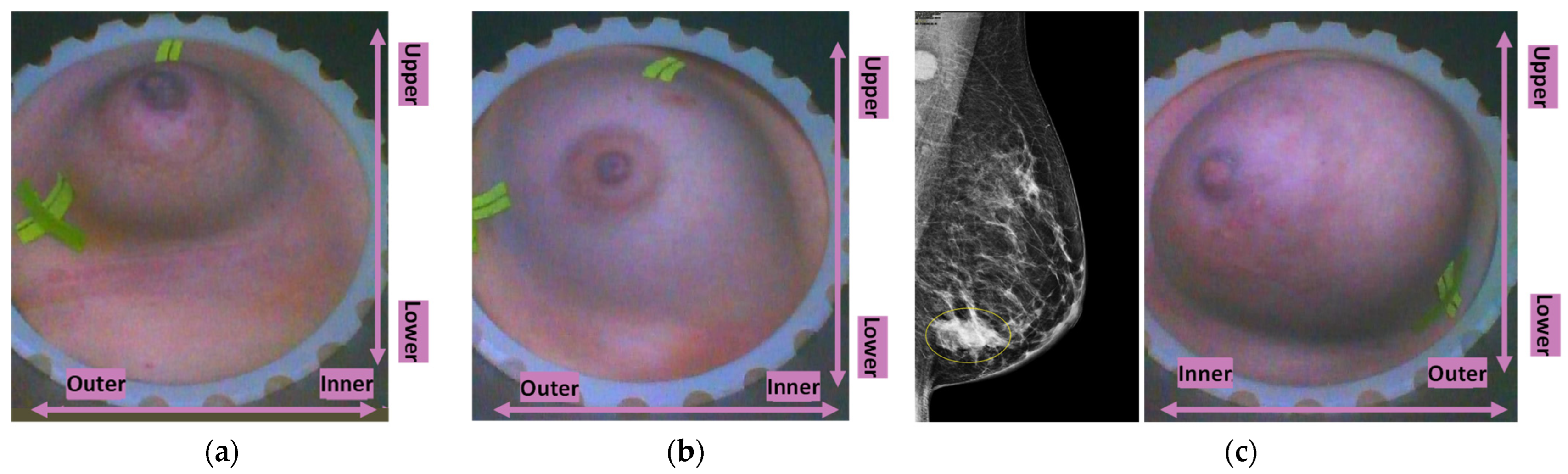 Cancers 17 02973 g004