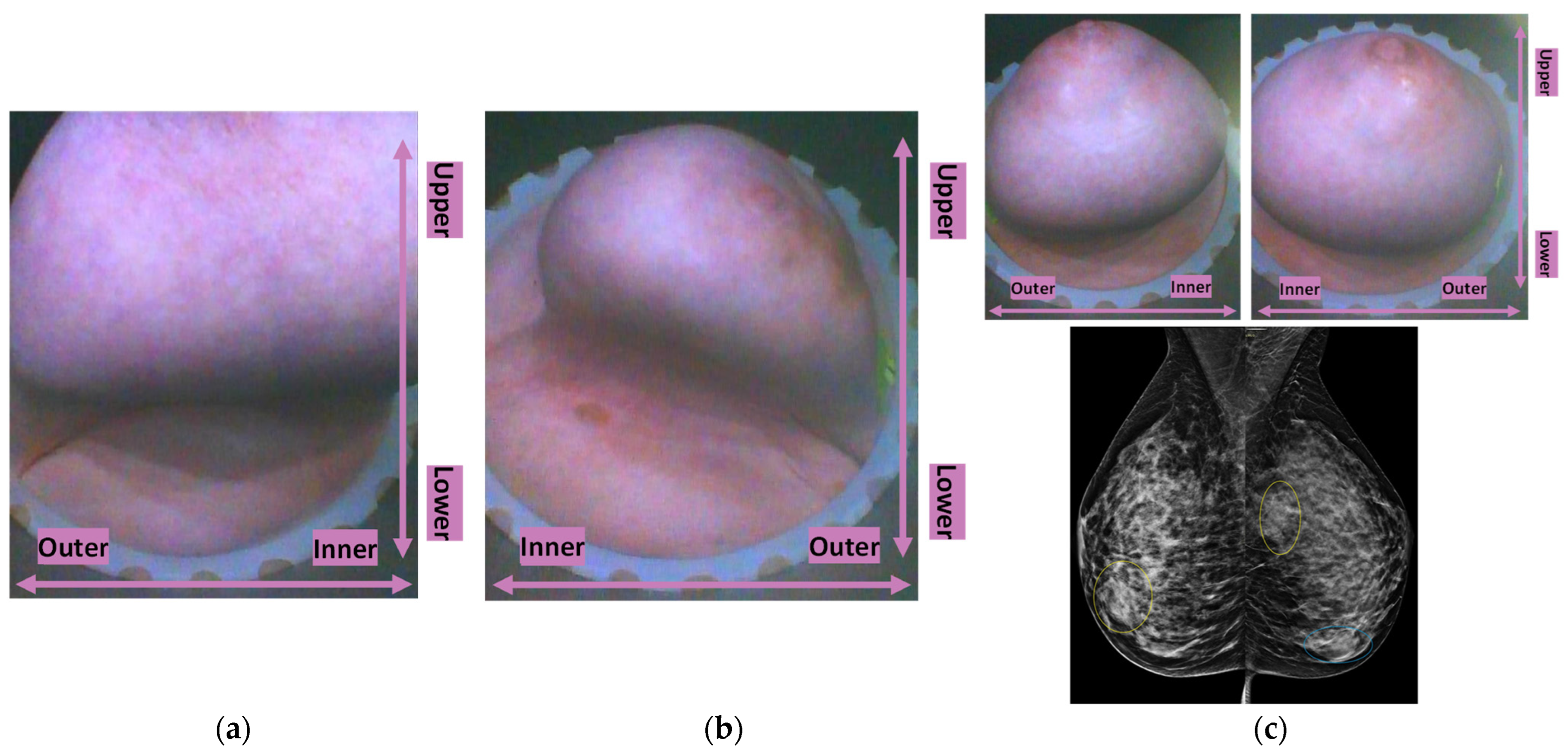 Cancers 17 02973 g005
