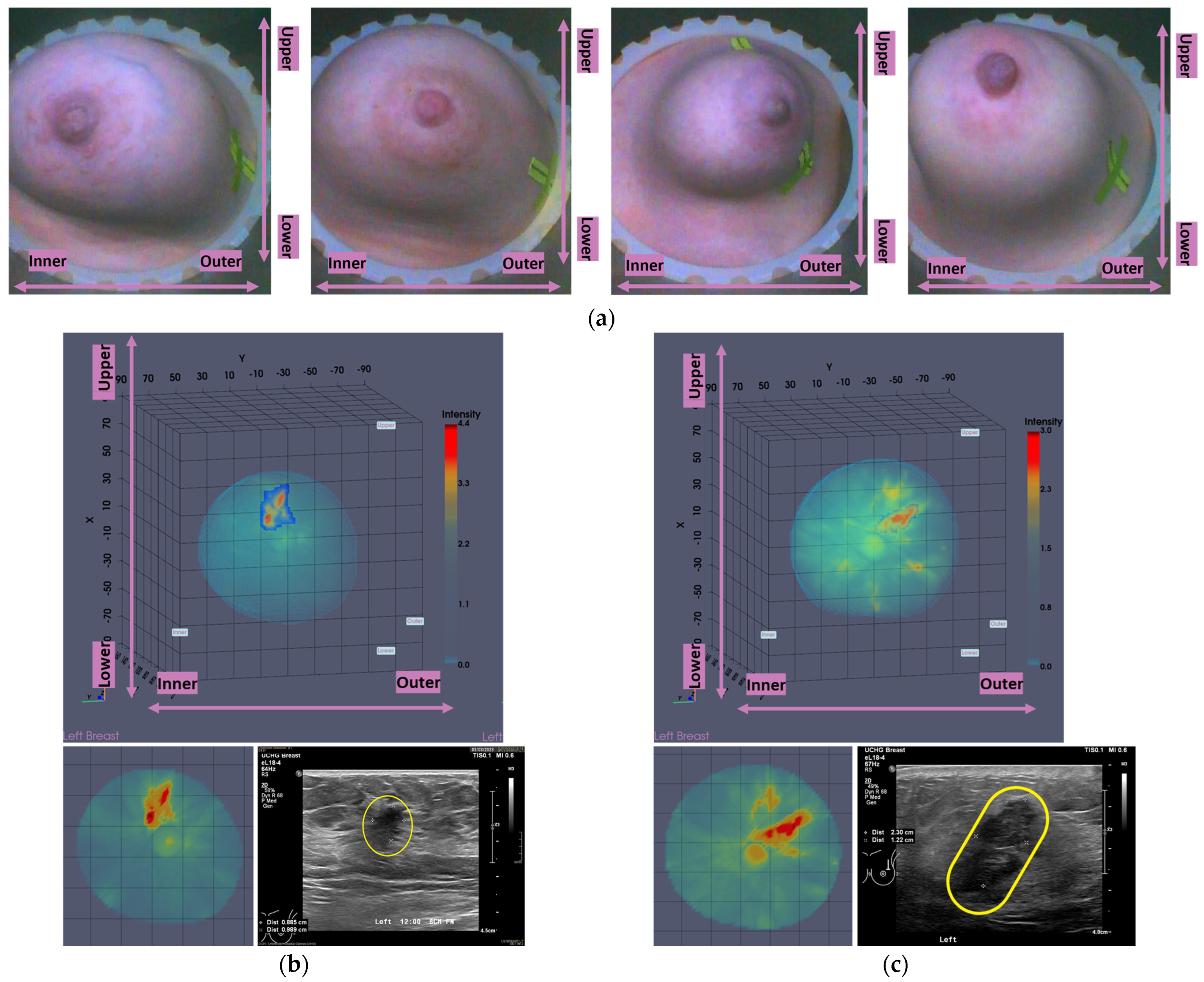 Cancers 17 02973 g009a