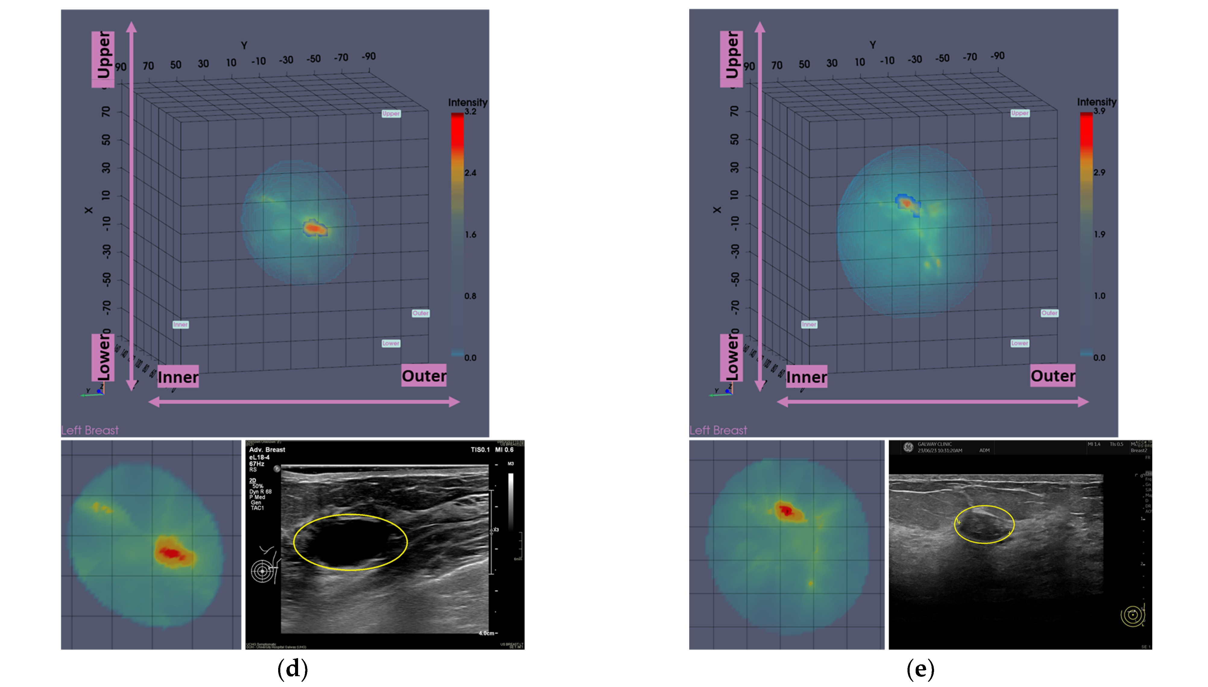 Cancers 17 02973 g009b
