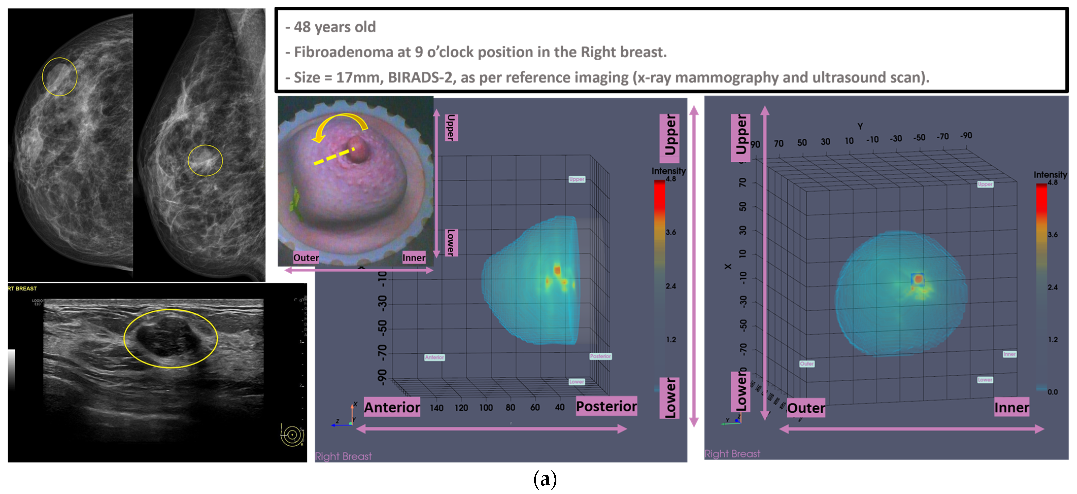 Cancers 17 02973 g0a1a