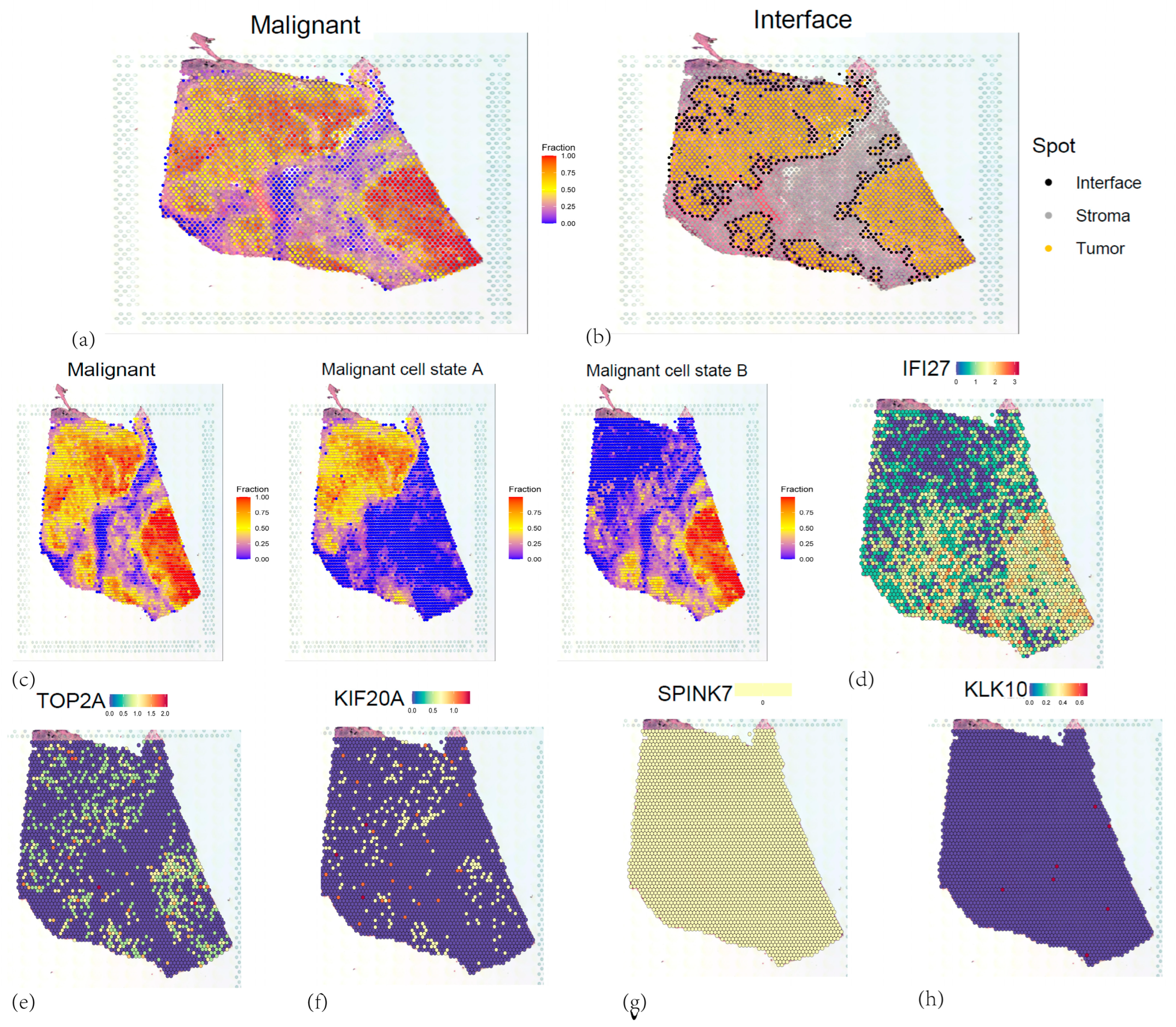 Cancers 17 02983 g013 Cancers 17 02983 g013