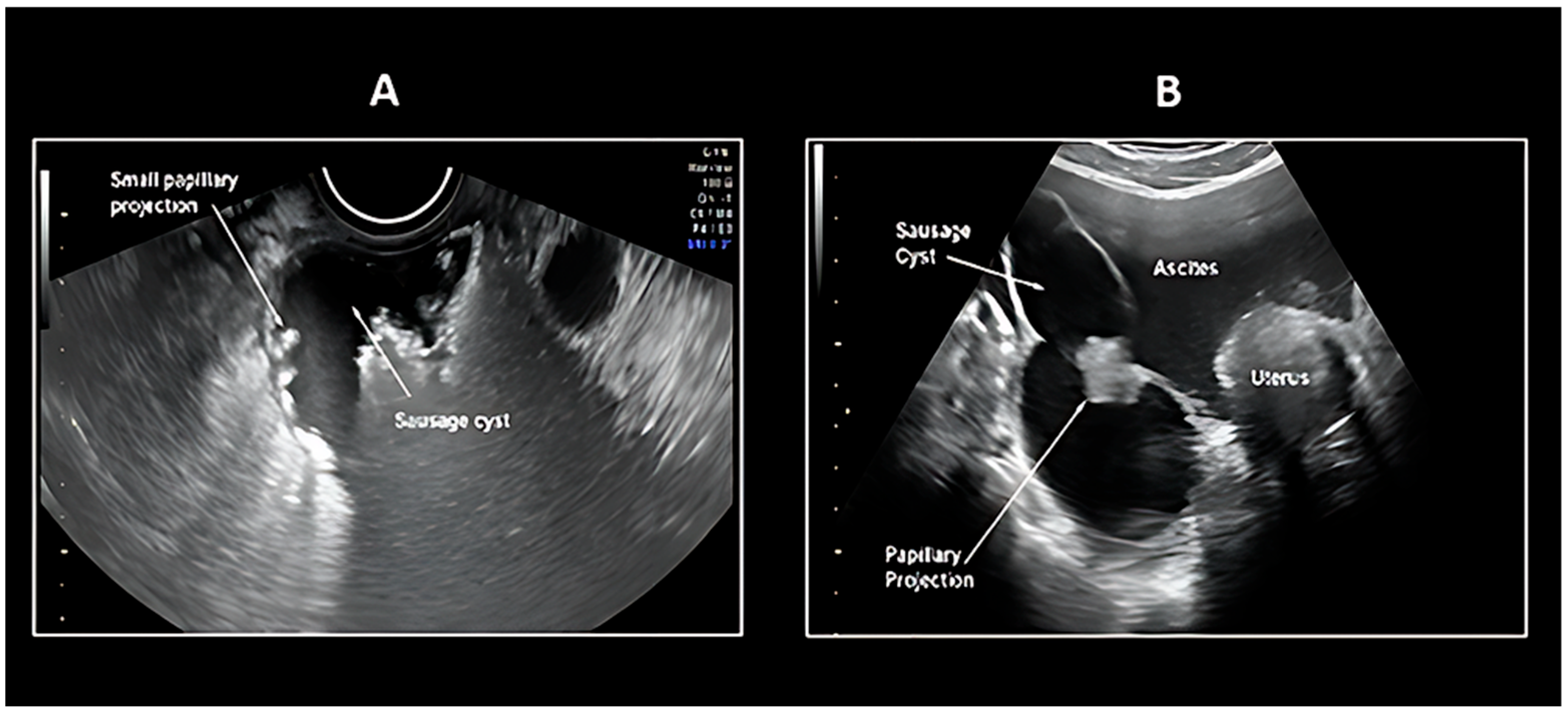 Cancers 17 02985 g001