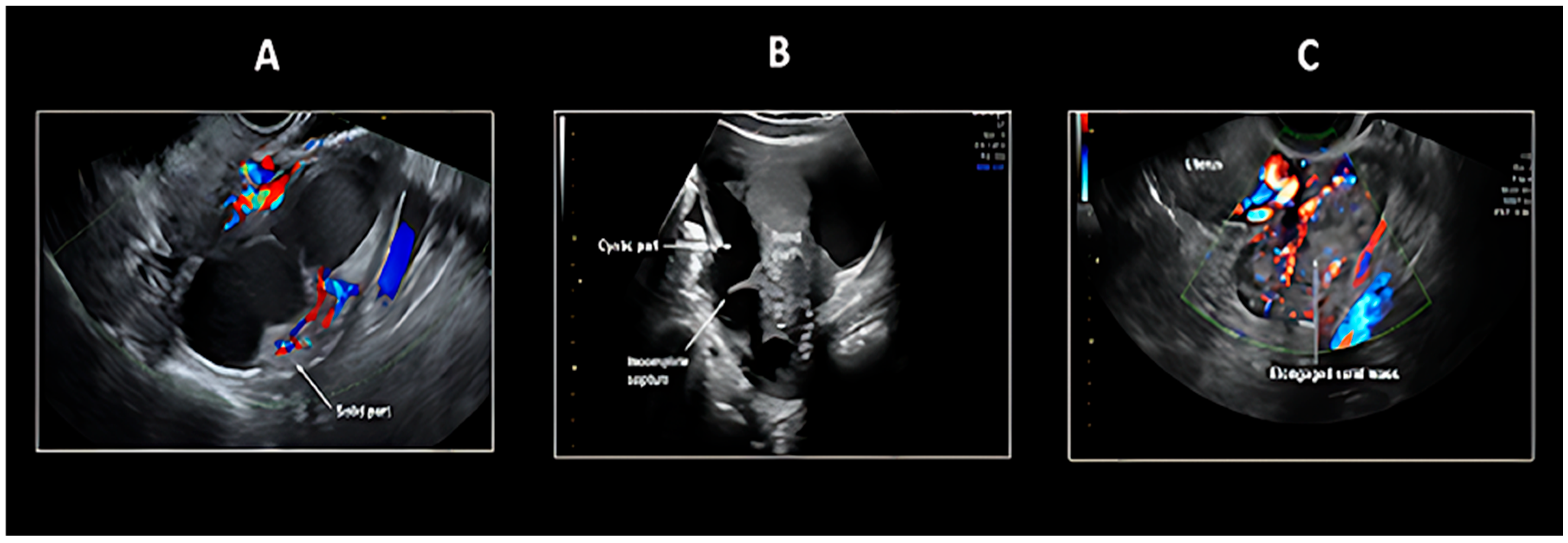 Cancers 17 02985 g002