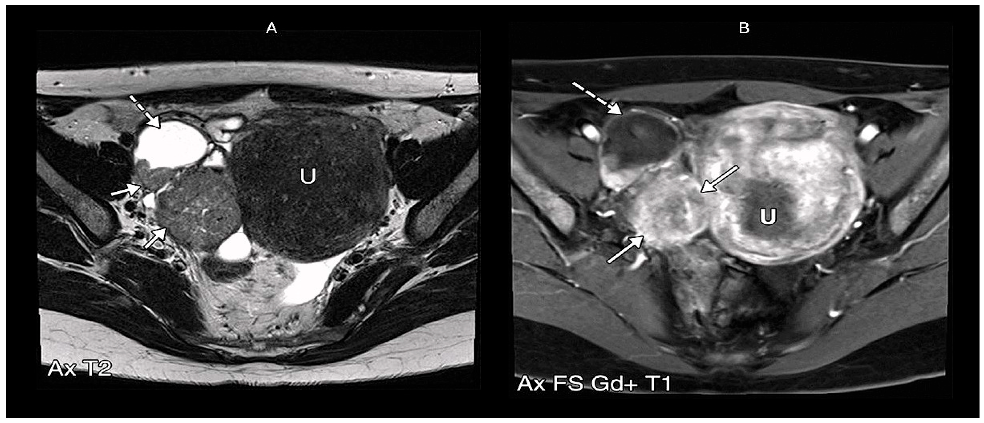 Cancers 17 02985 g004