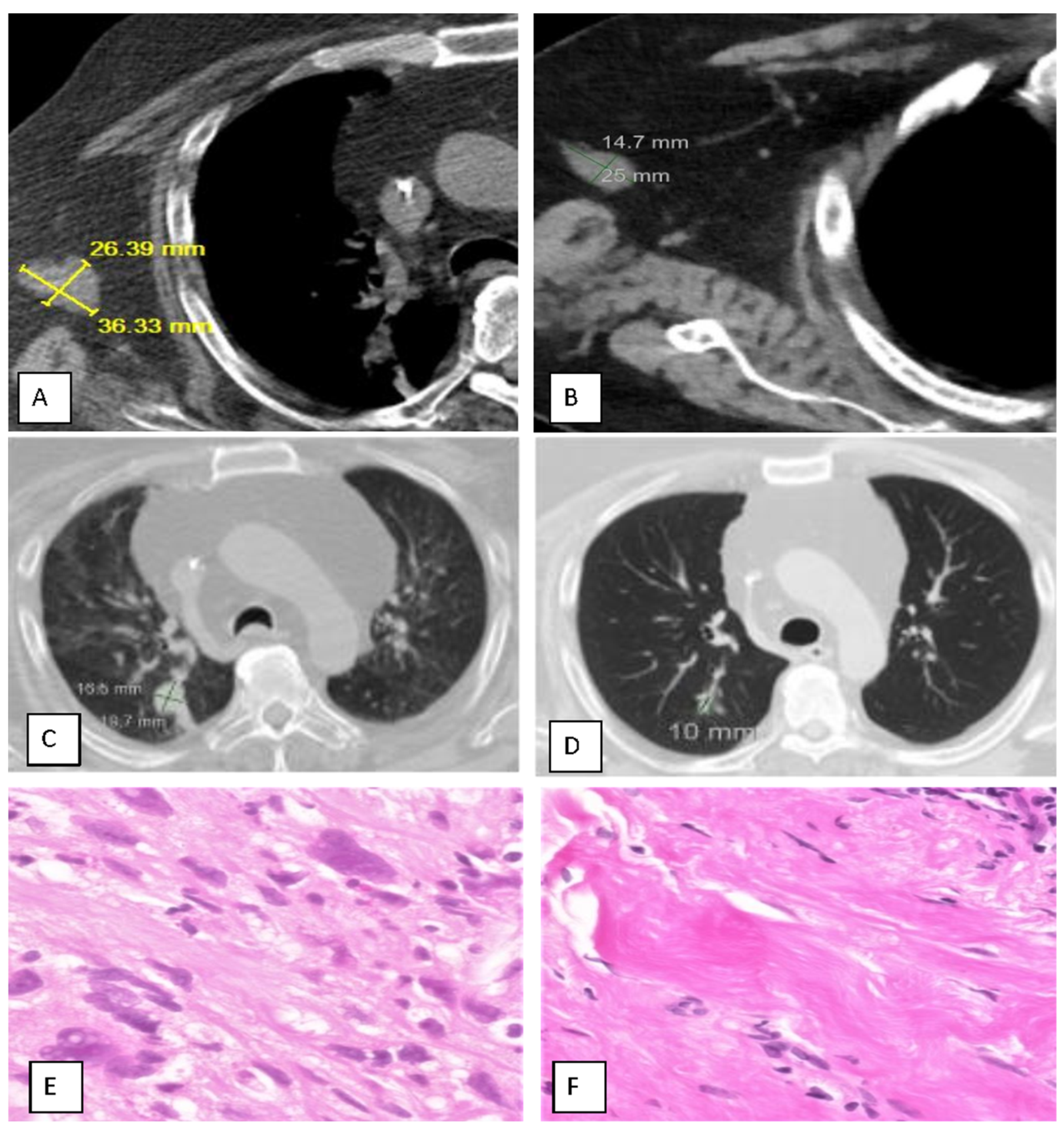 Cancers 17 02990 g001