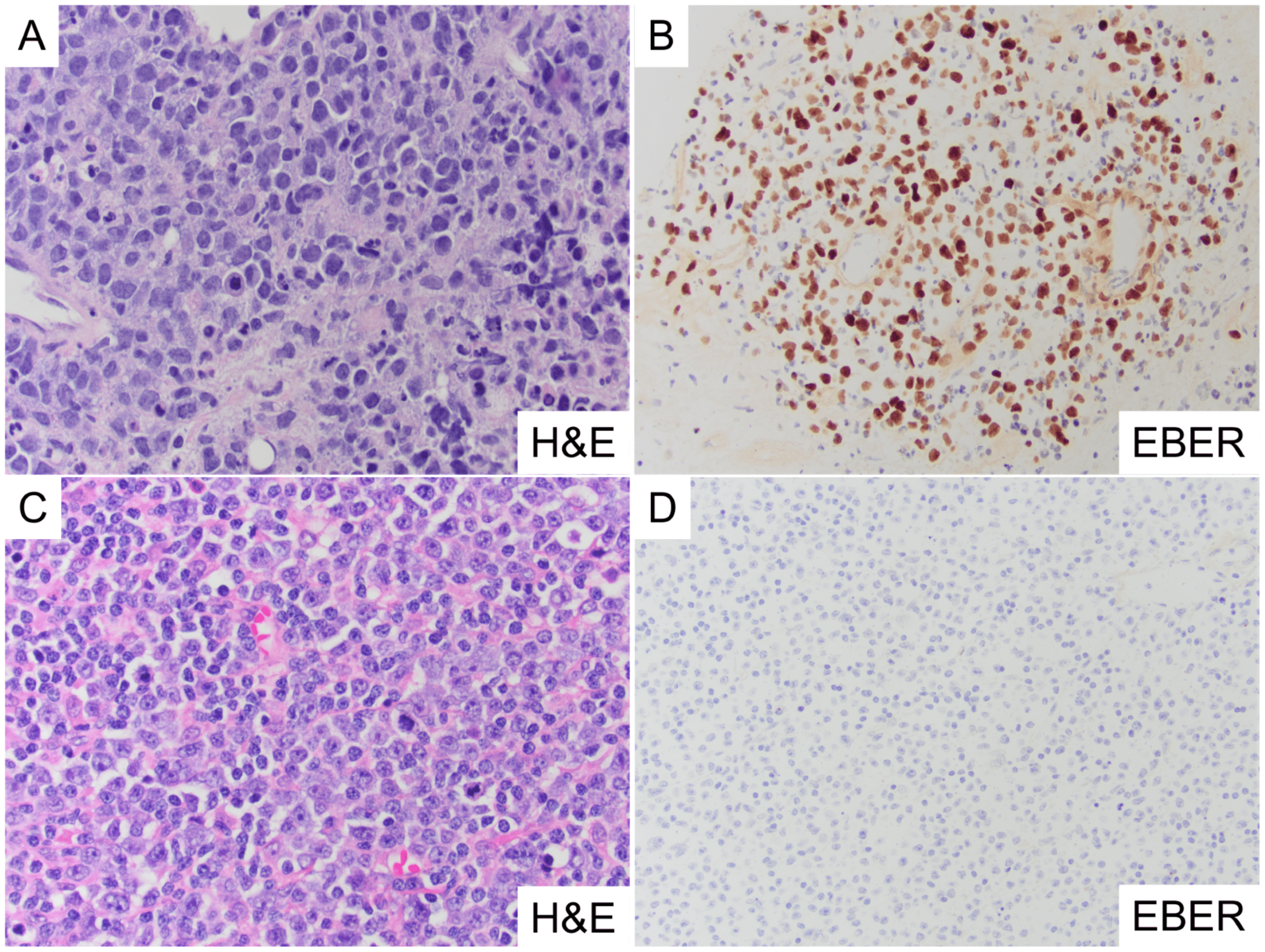 Cancers 17 02994 g001 Cancers 17 02994 g001