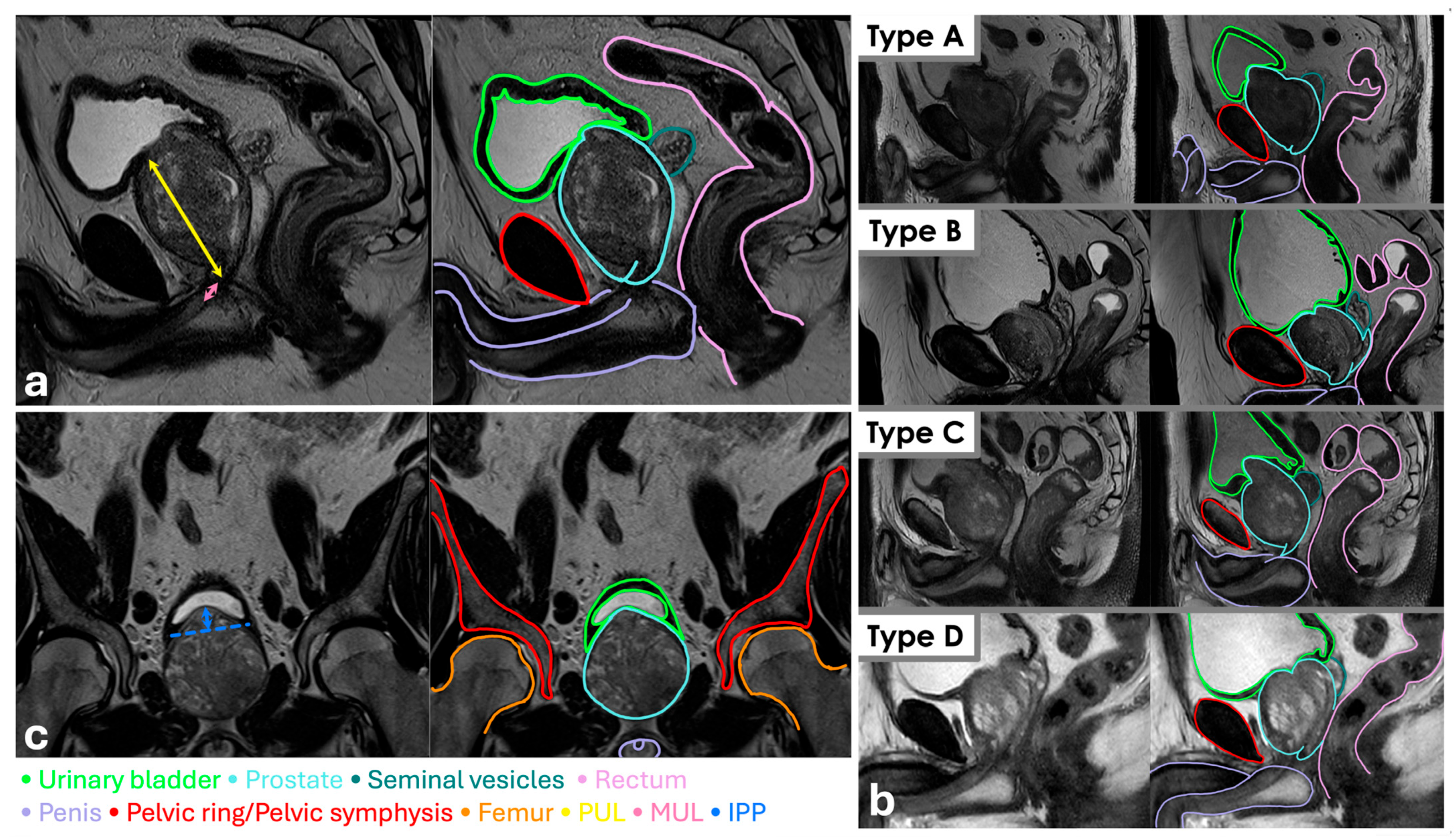 Cancers 17 03004 g001