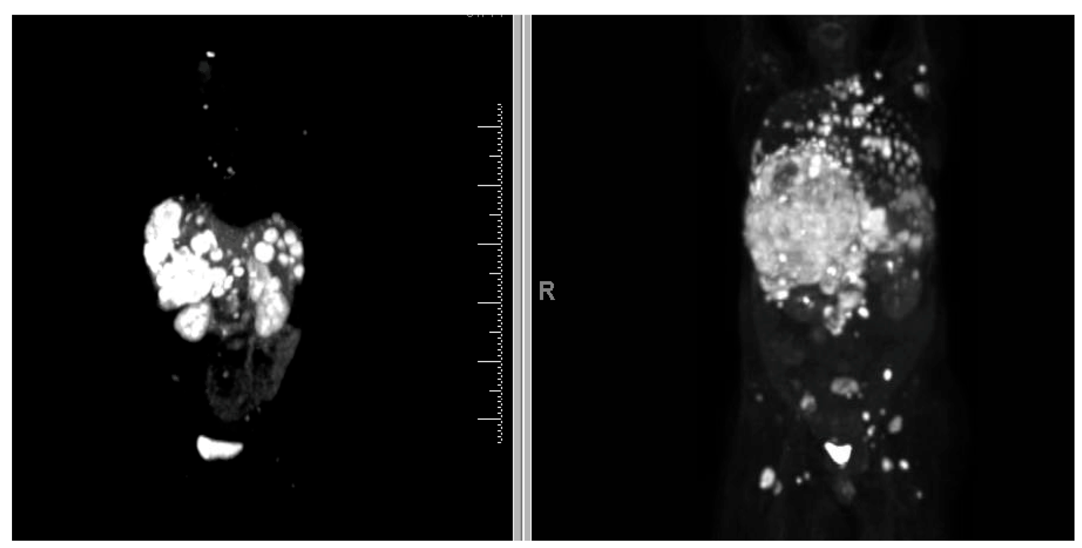 Cancers 17 03008 g002 Cancers 17 03008 g002