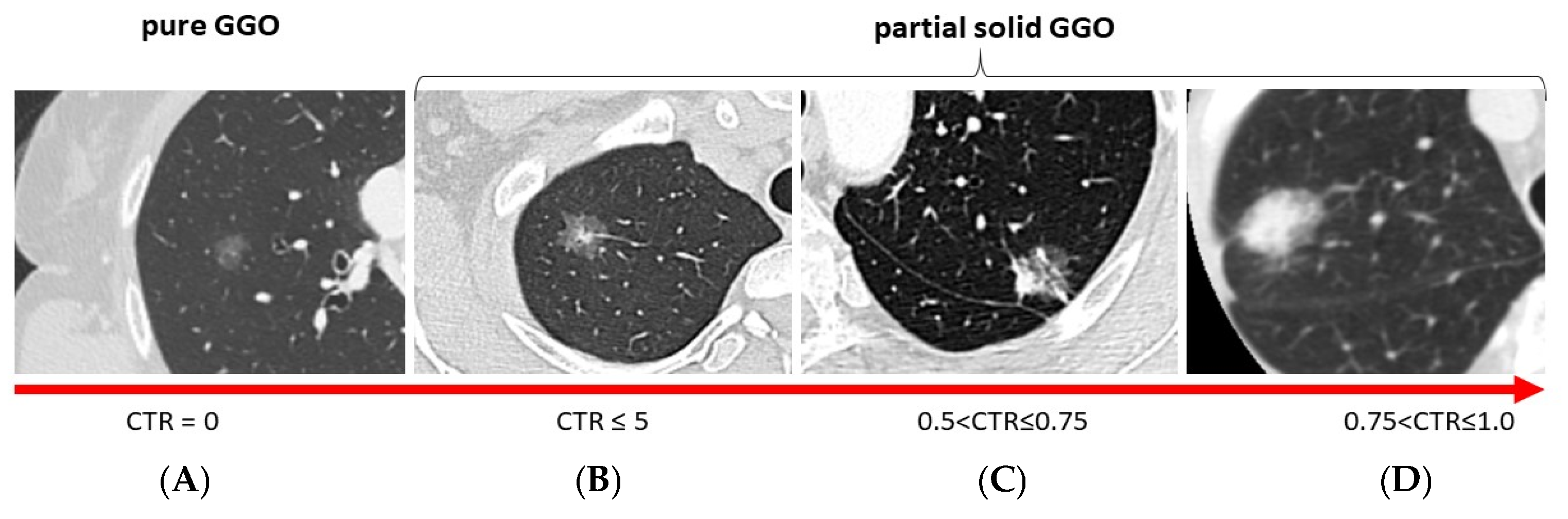 Cancers 17 03016 g001 Cancers 17 03016 g001