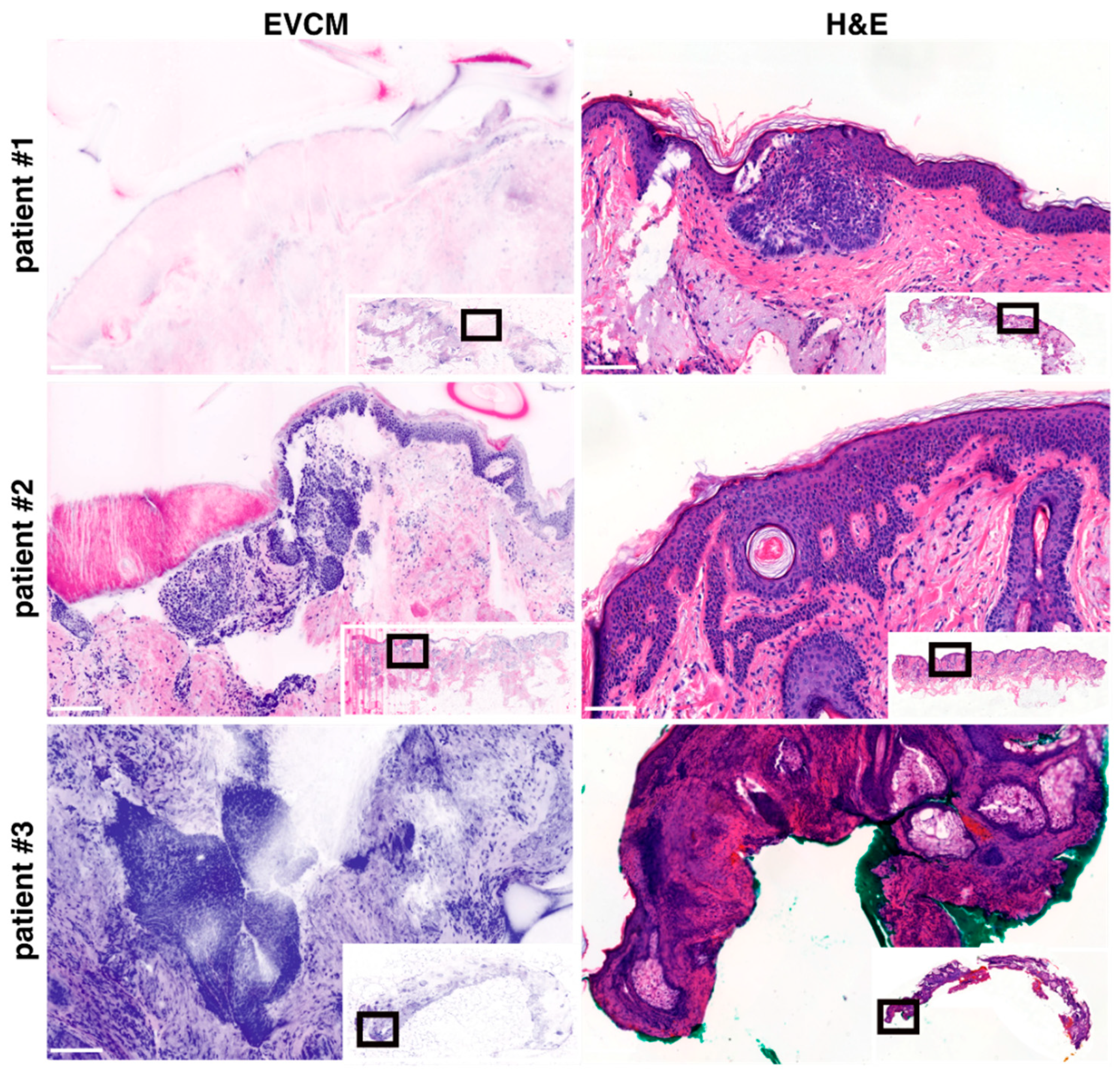 Cancers 17 03019 g003
