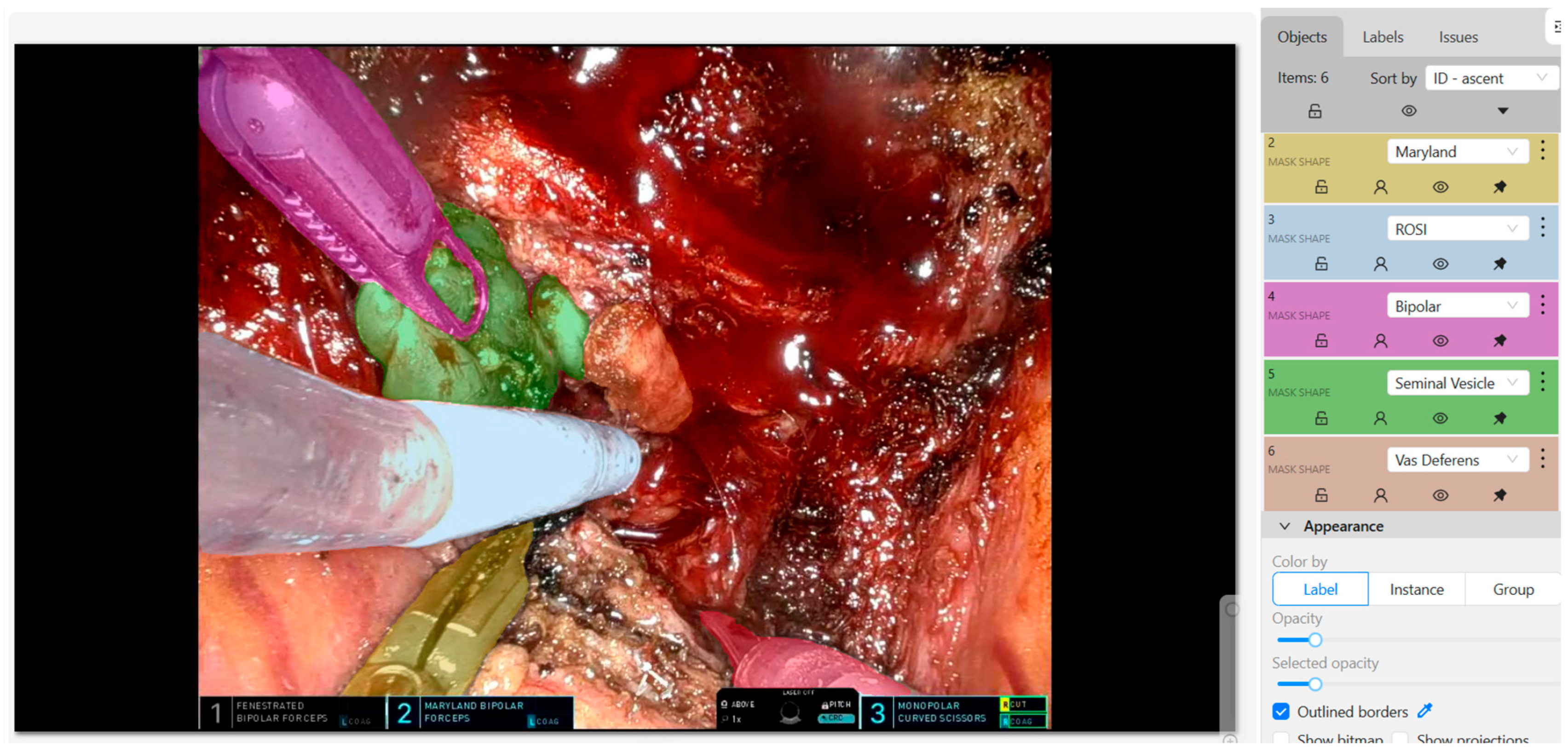 Cancers 17 03053 g002