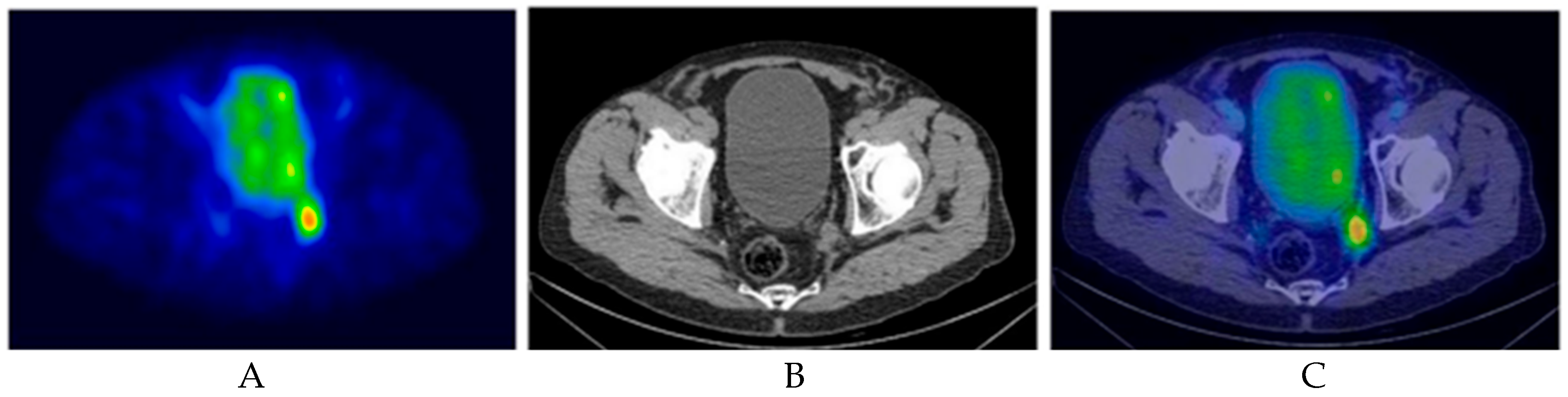 Cancers 17 03053 g004