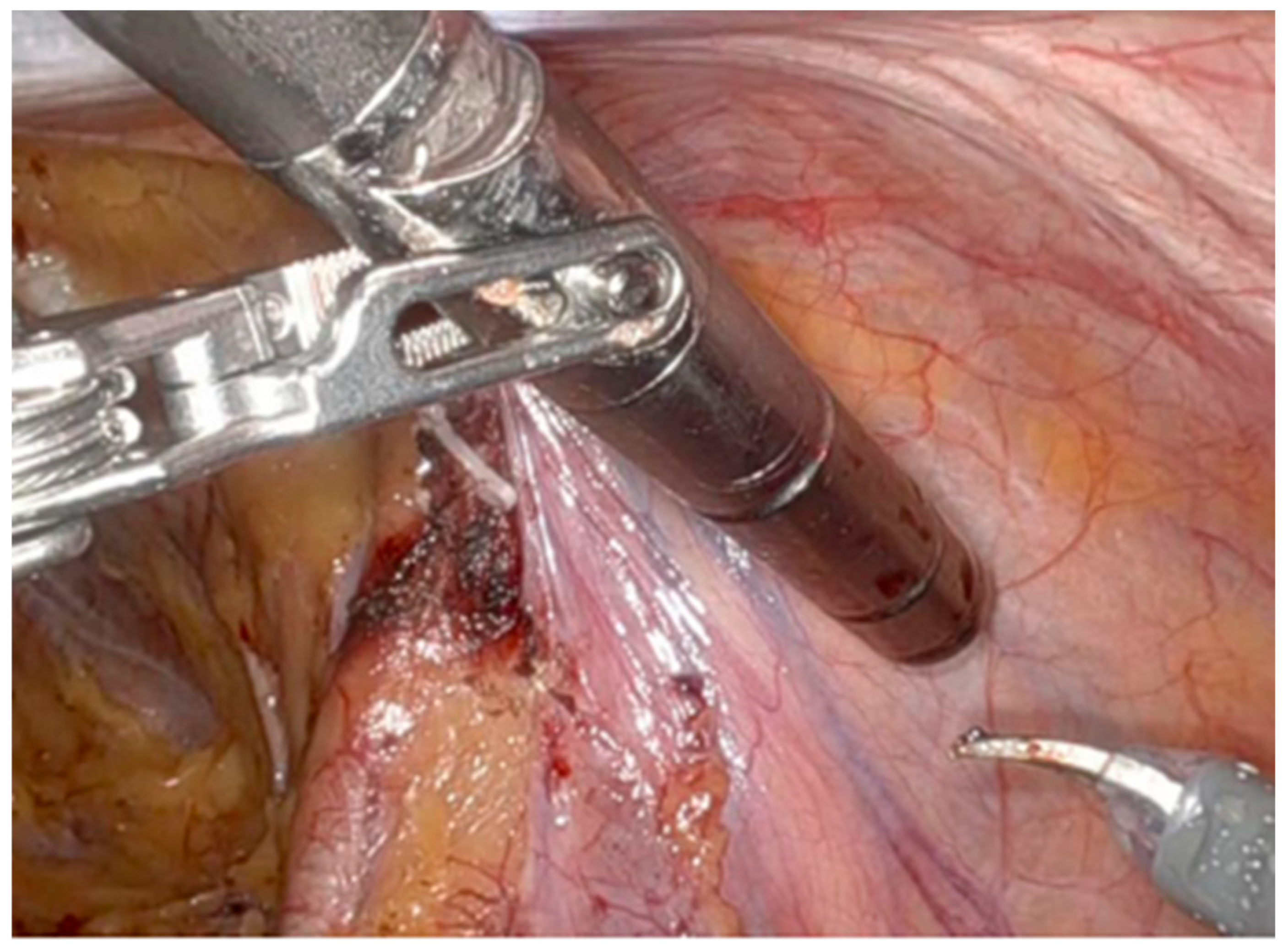 Cancers 17 03053 g005