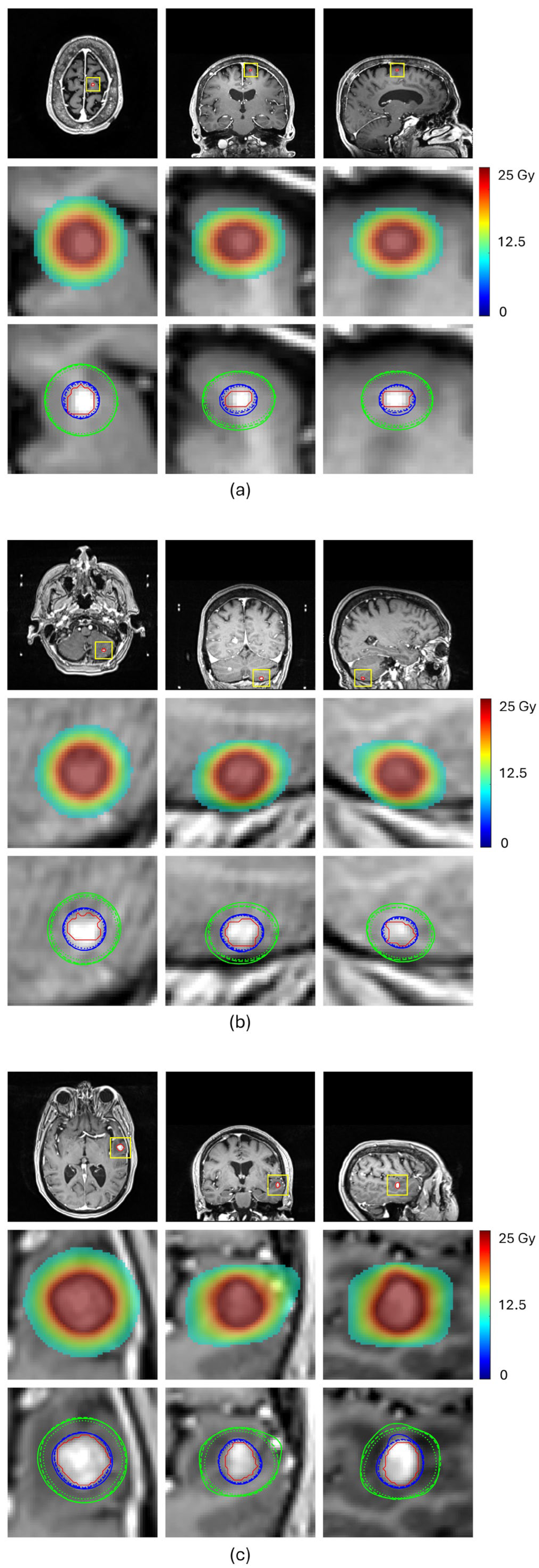 Cancers 17 03056 g004a