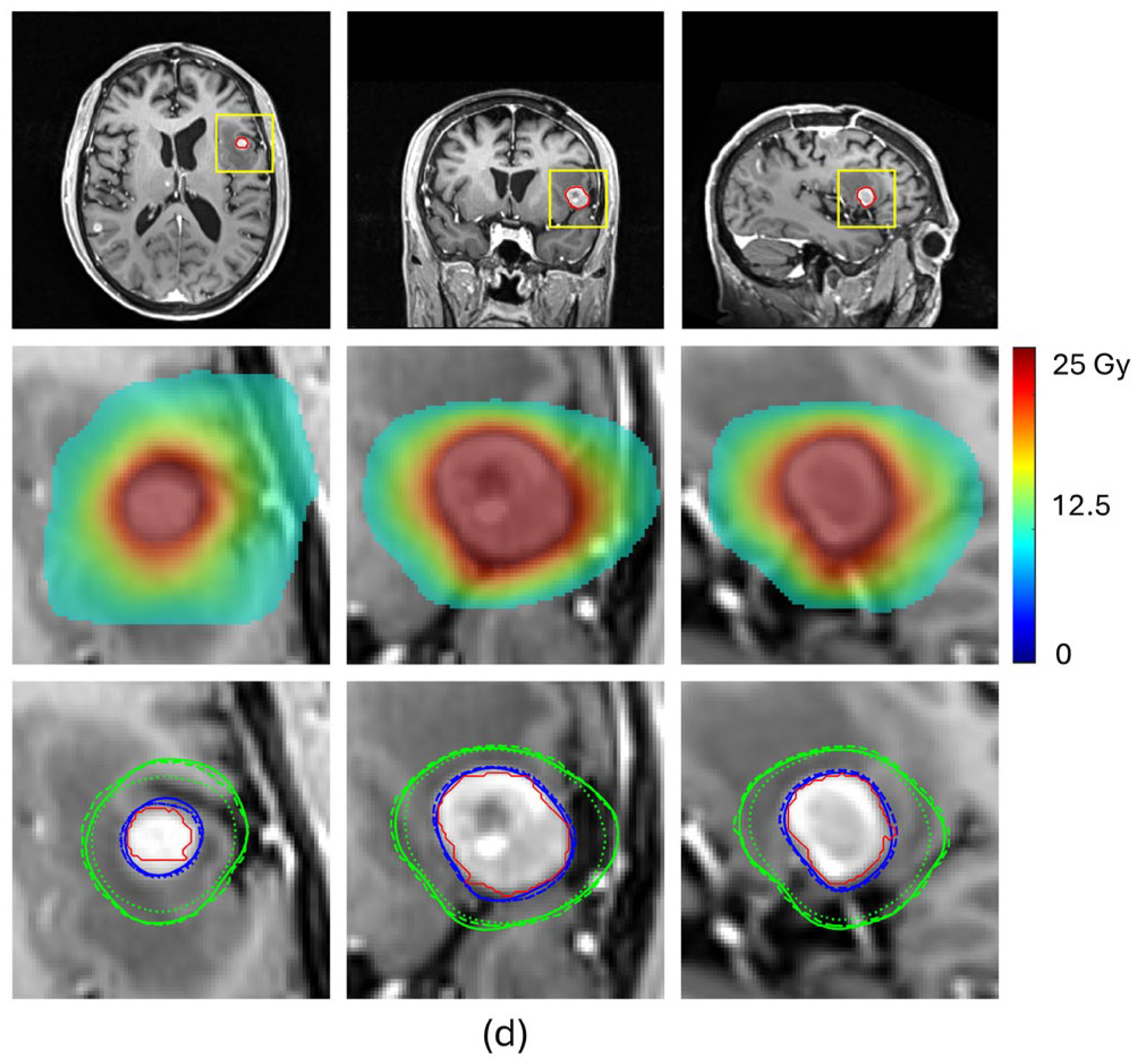 Cancers 17 03056 g004b