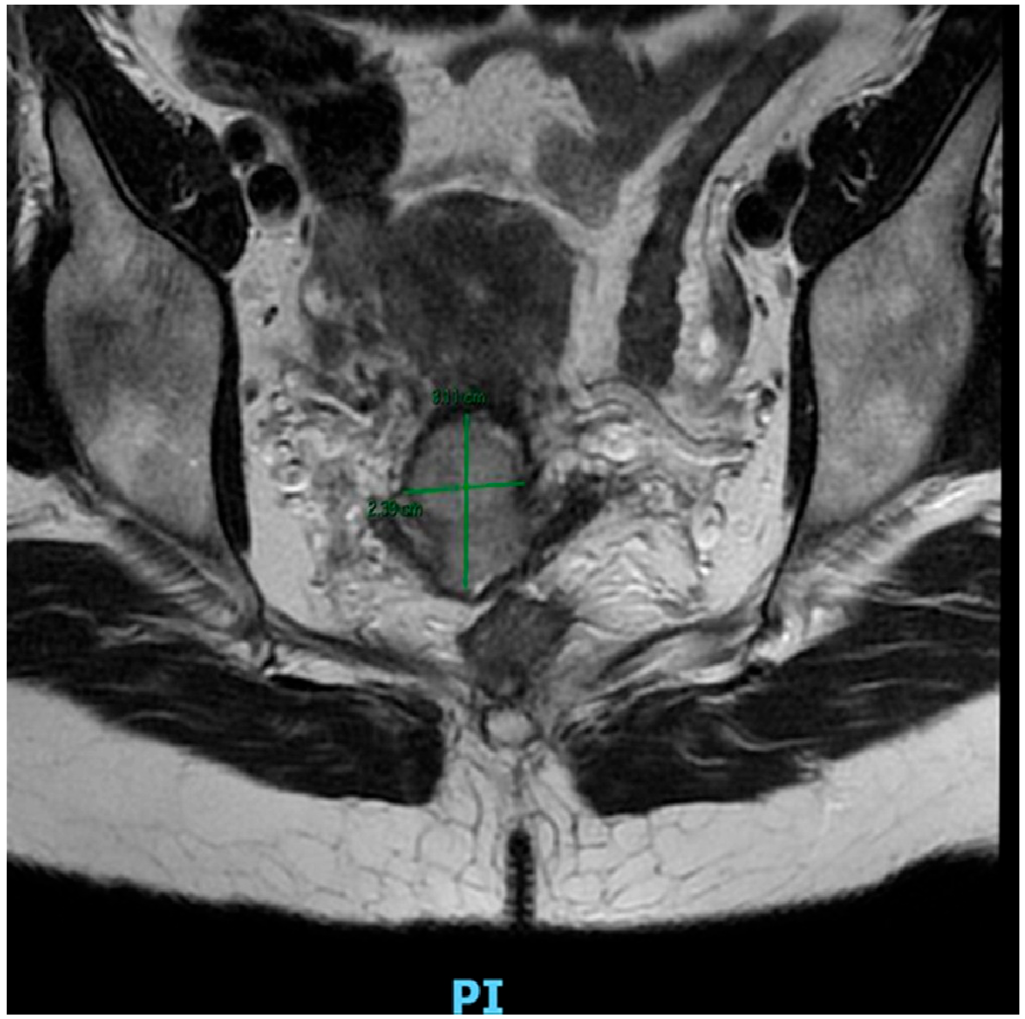 Cancers 17 03057 g001